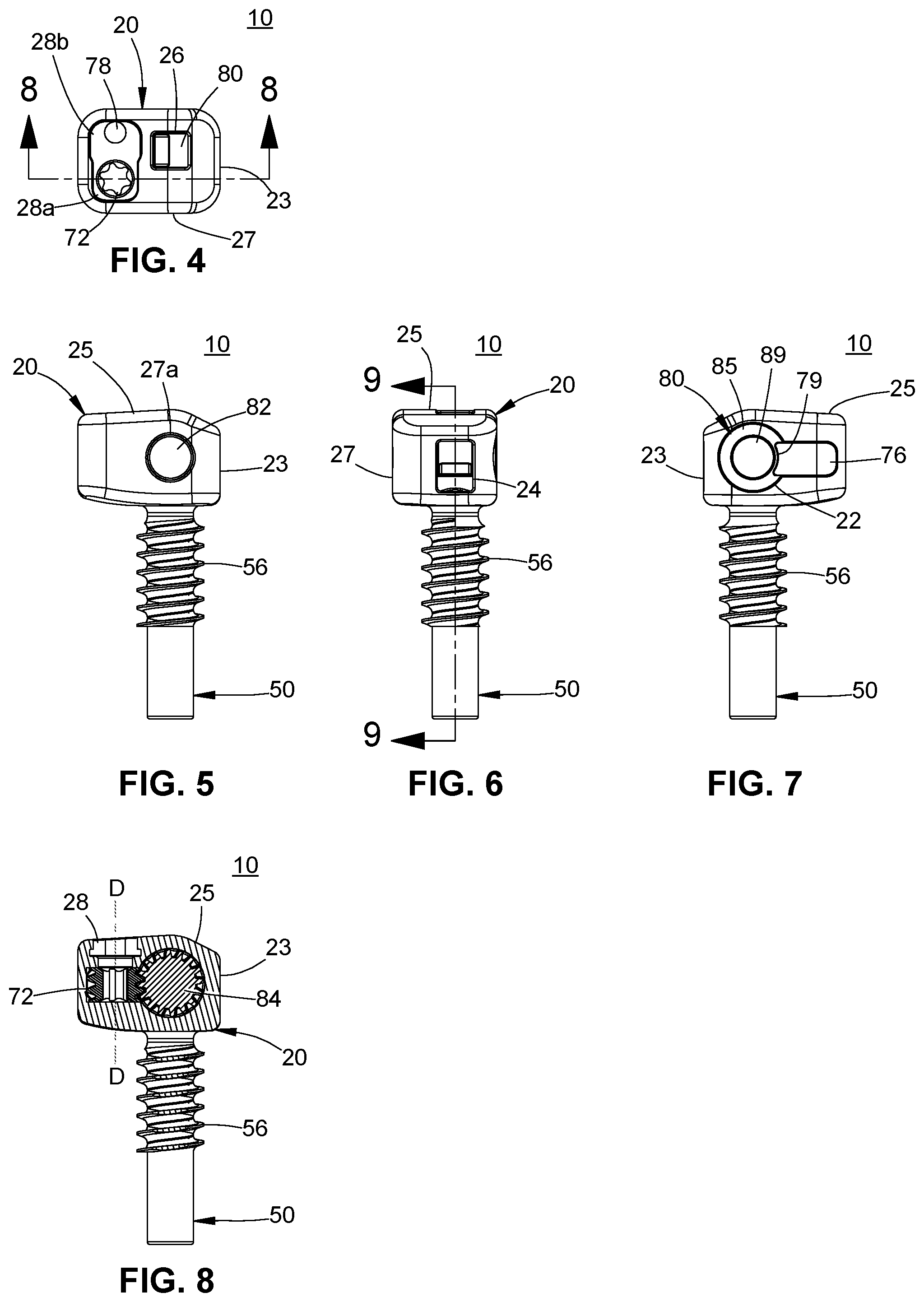 Patent US11771474 Figure 3 – Band tensioning system
