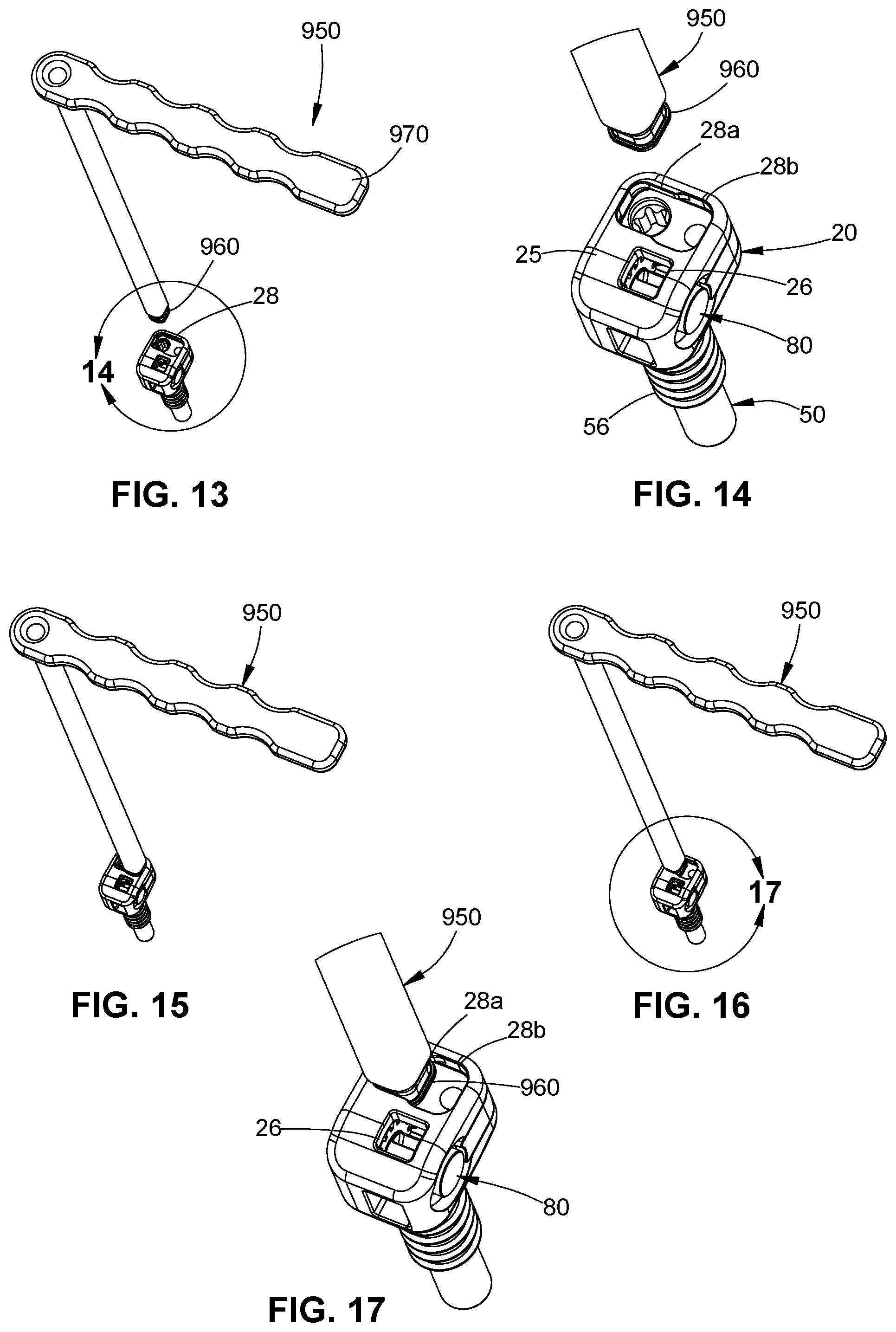 Patent US11771474 Figure 6 – Band tensioning system