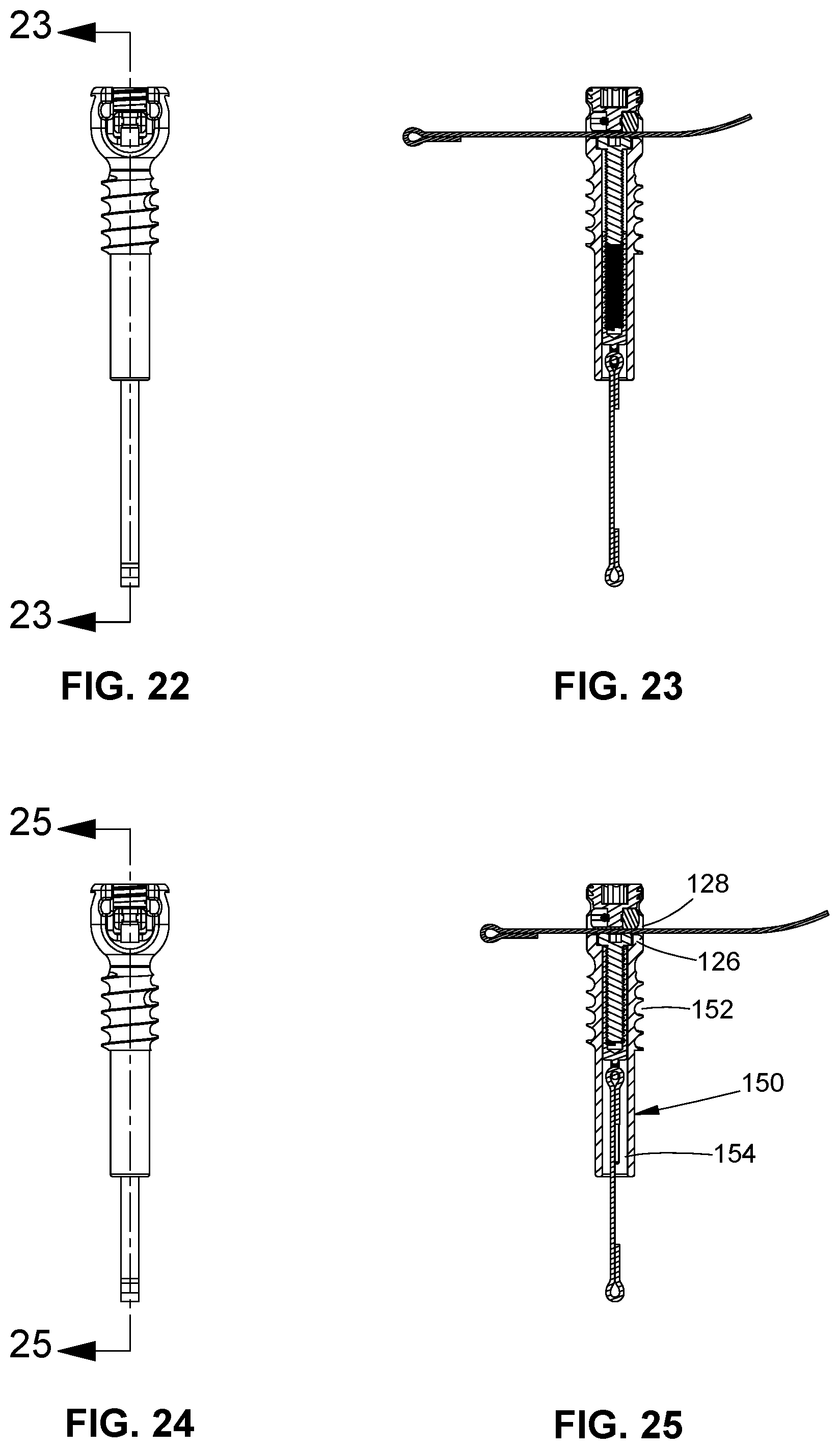 Patent US11771474 Figure 9 – Band tensioning system
