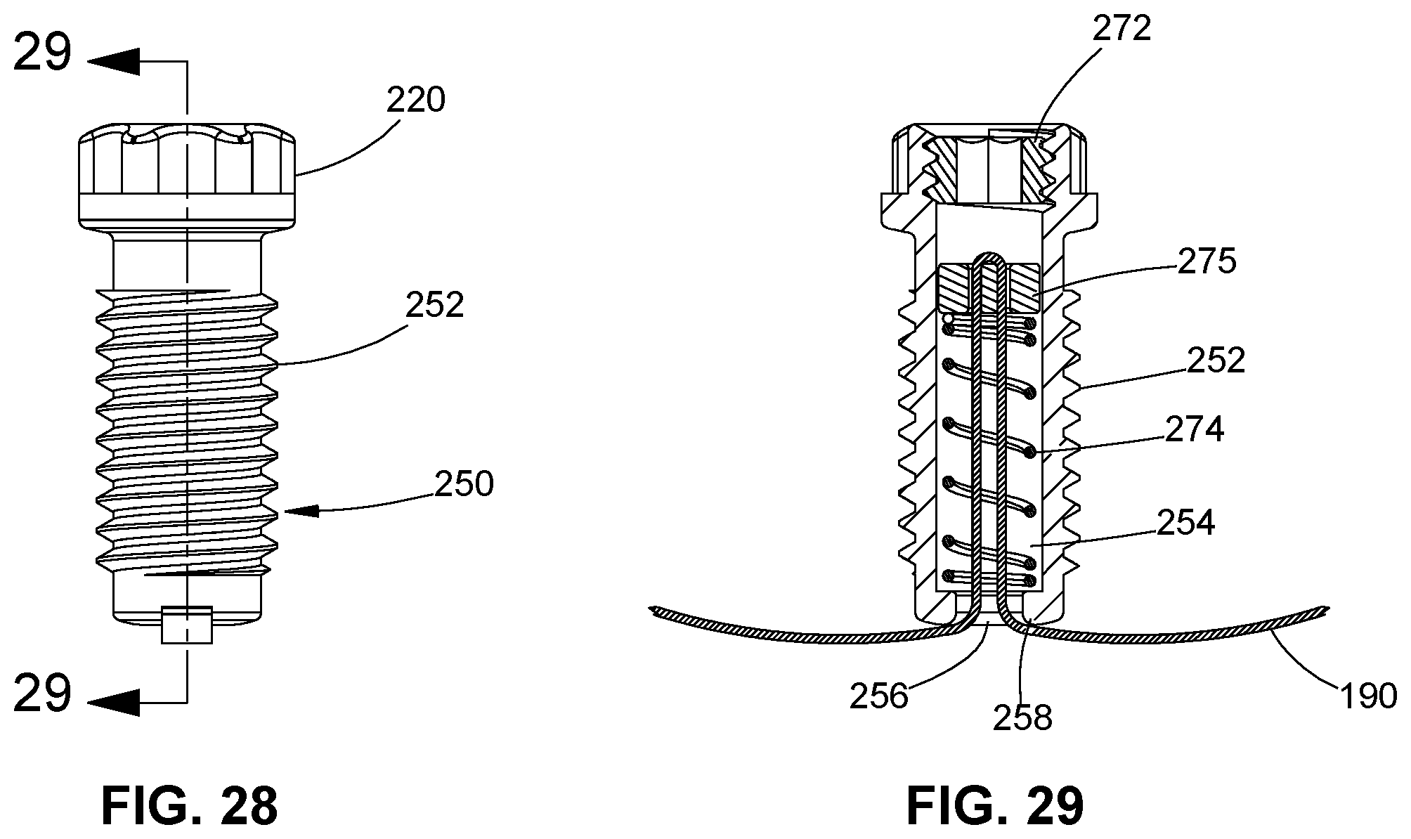 Patent US11771474 Figure 11 – Band tensioning system