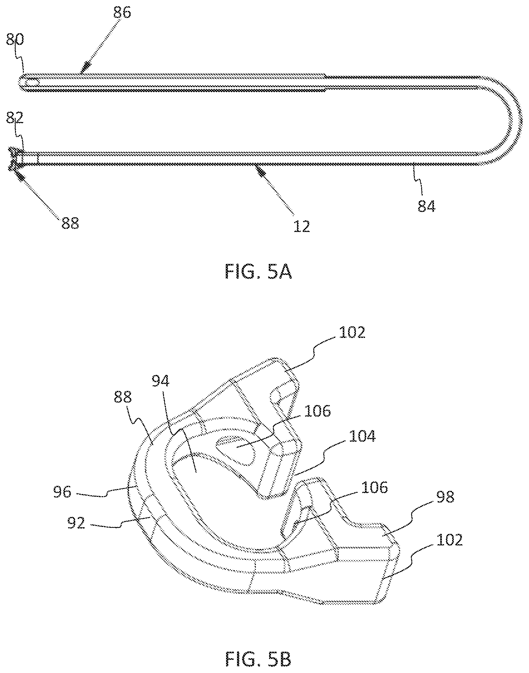 Patent US11771475 Figure 3 – Systems and methods for surgical procedures using band clamp implants and tensioning instruments