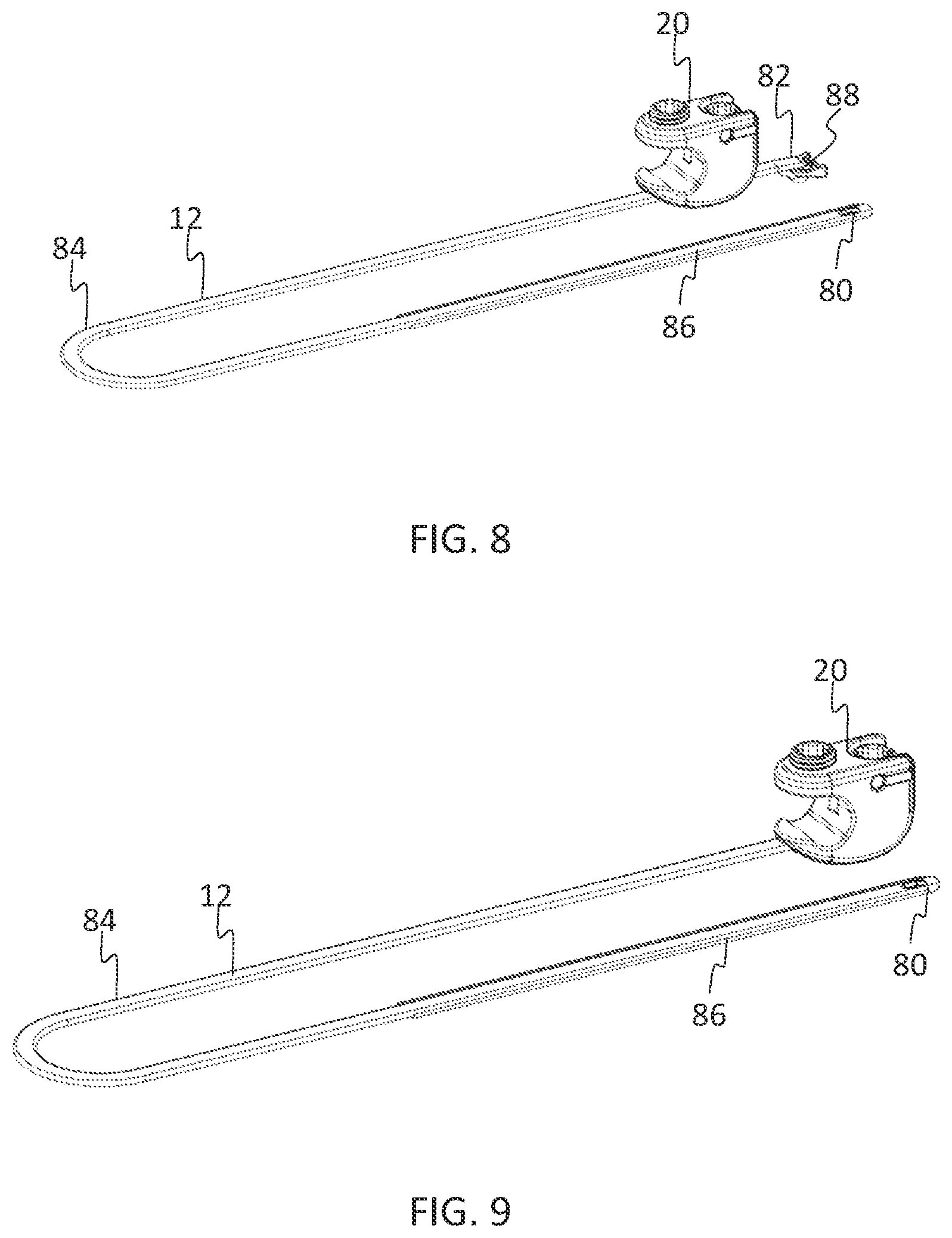 Patent US11771475 Figure 5 – Systems and methods for surgical procedures using band clamp implants and tensioning instruments