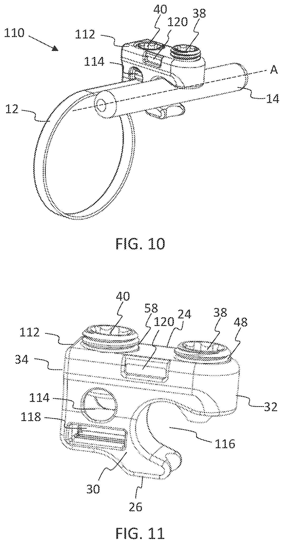Patent US11771475 Figure 6 – Systems and methods for surgical procedures using band clamp implants and tensioning instruments