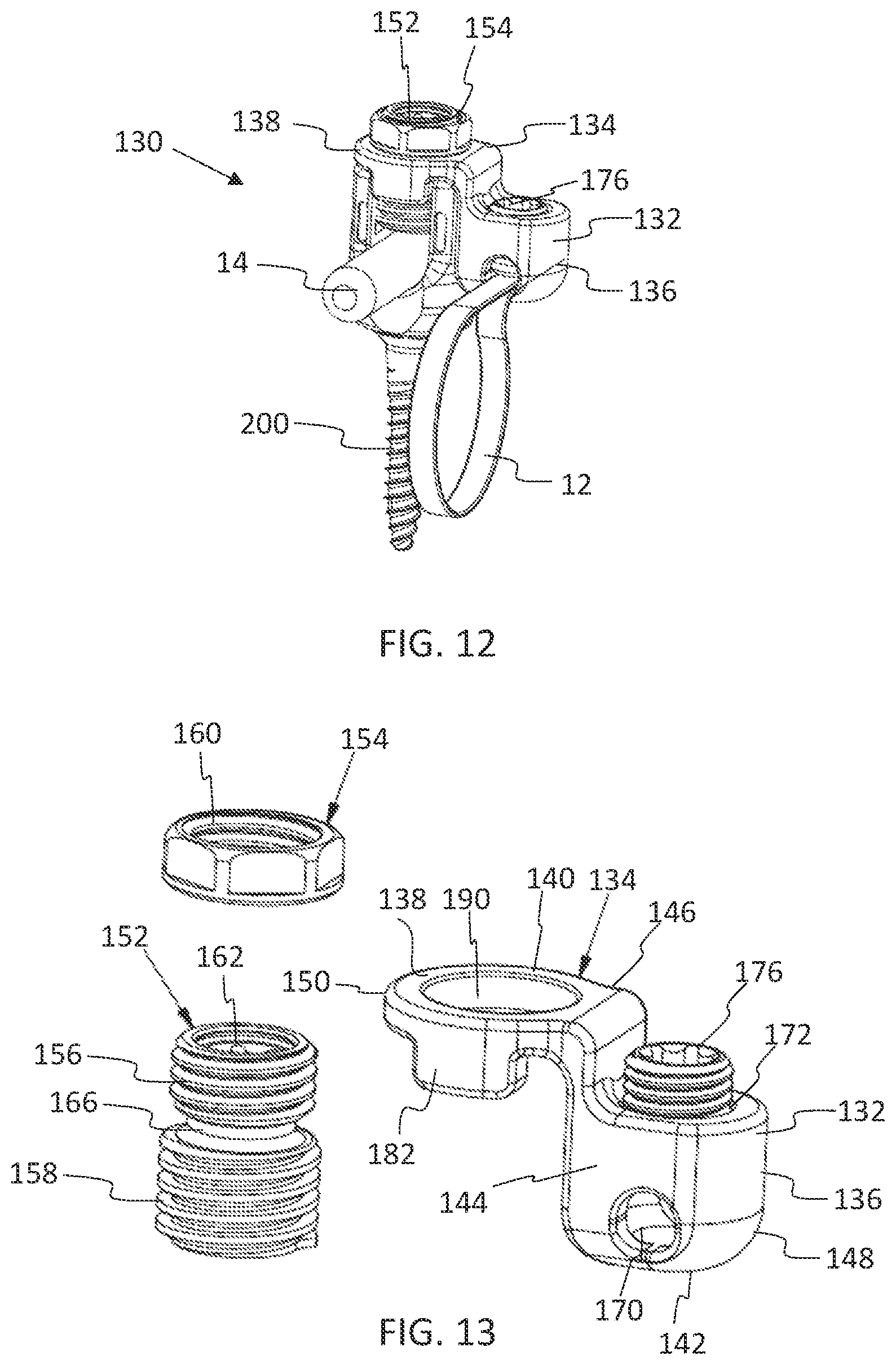 Patent US11771475 Figure 7 – Systems and methods for surgical procedures using band clamp implants and tensioning instruments