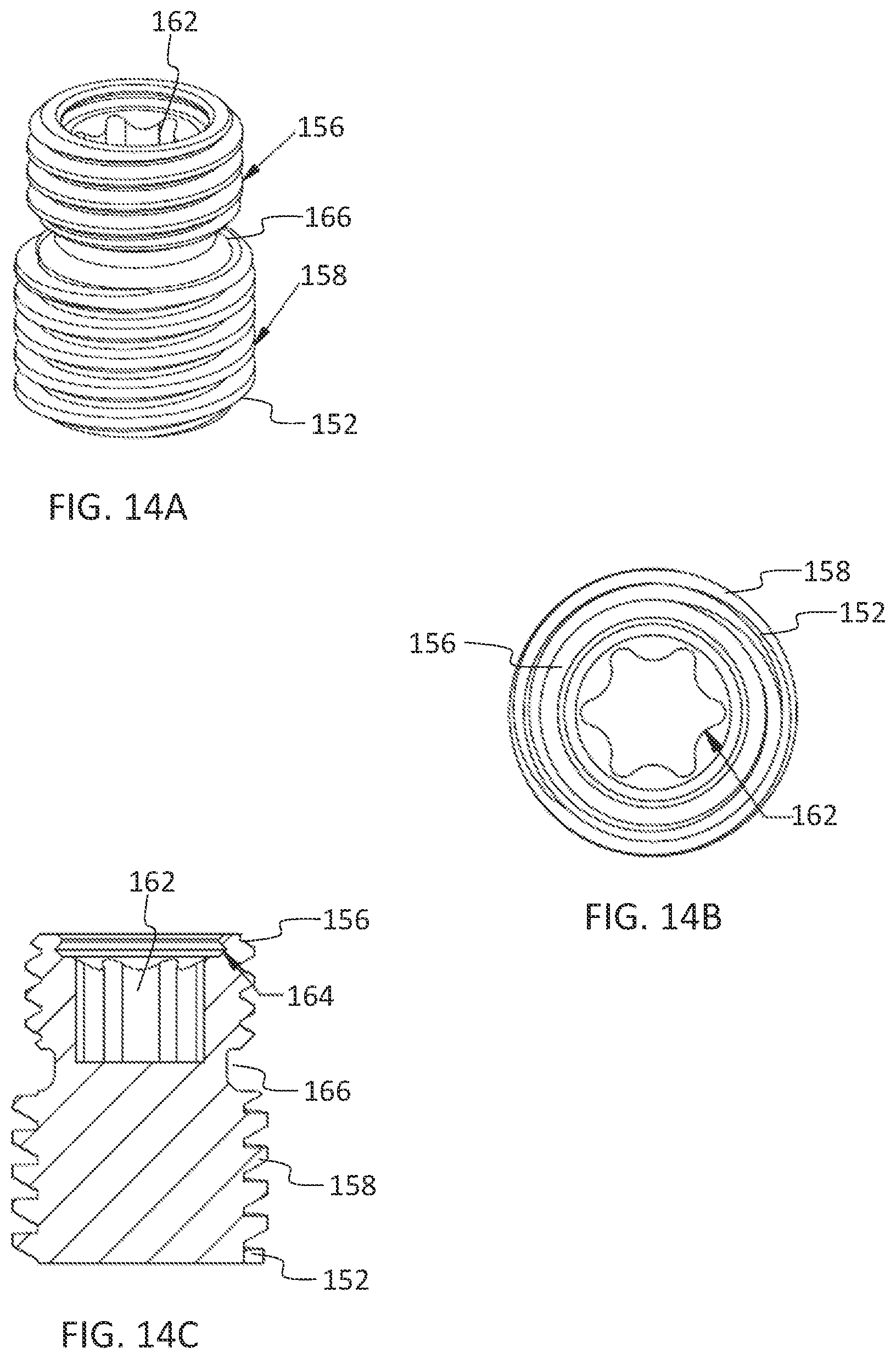 Patent US11771475 Figure 8 – Systems and methods for surgical procedures using band clamp implants and tensioning instruments