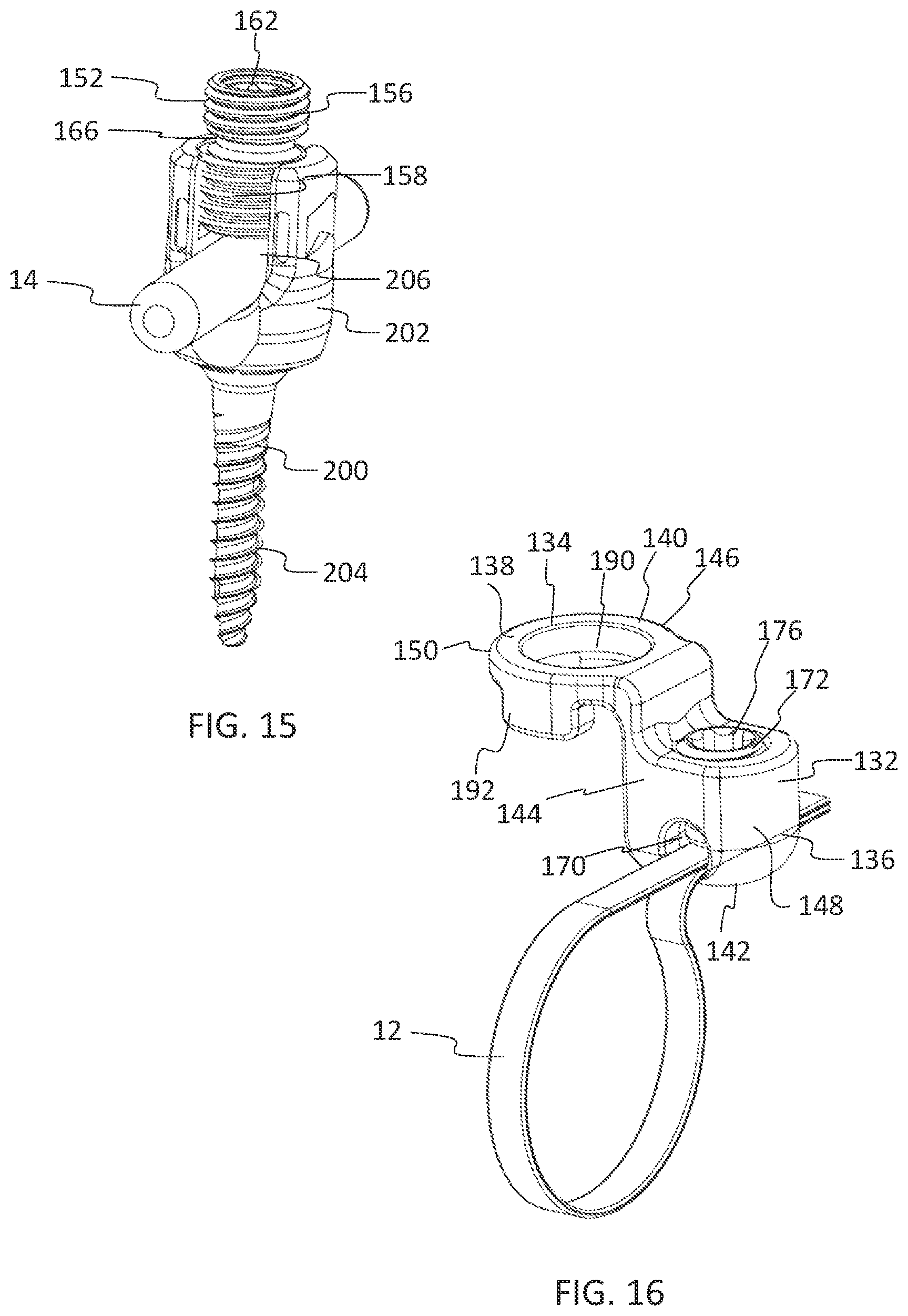 Patent US11771475 Figure 9 – Systems and methods for surgical procedures using band clamp implants and tensioning instruments