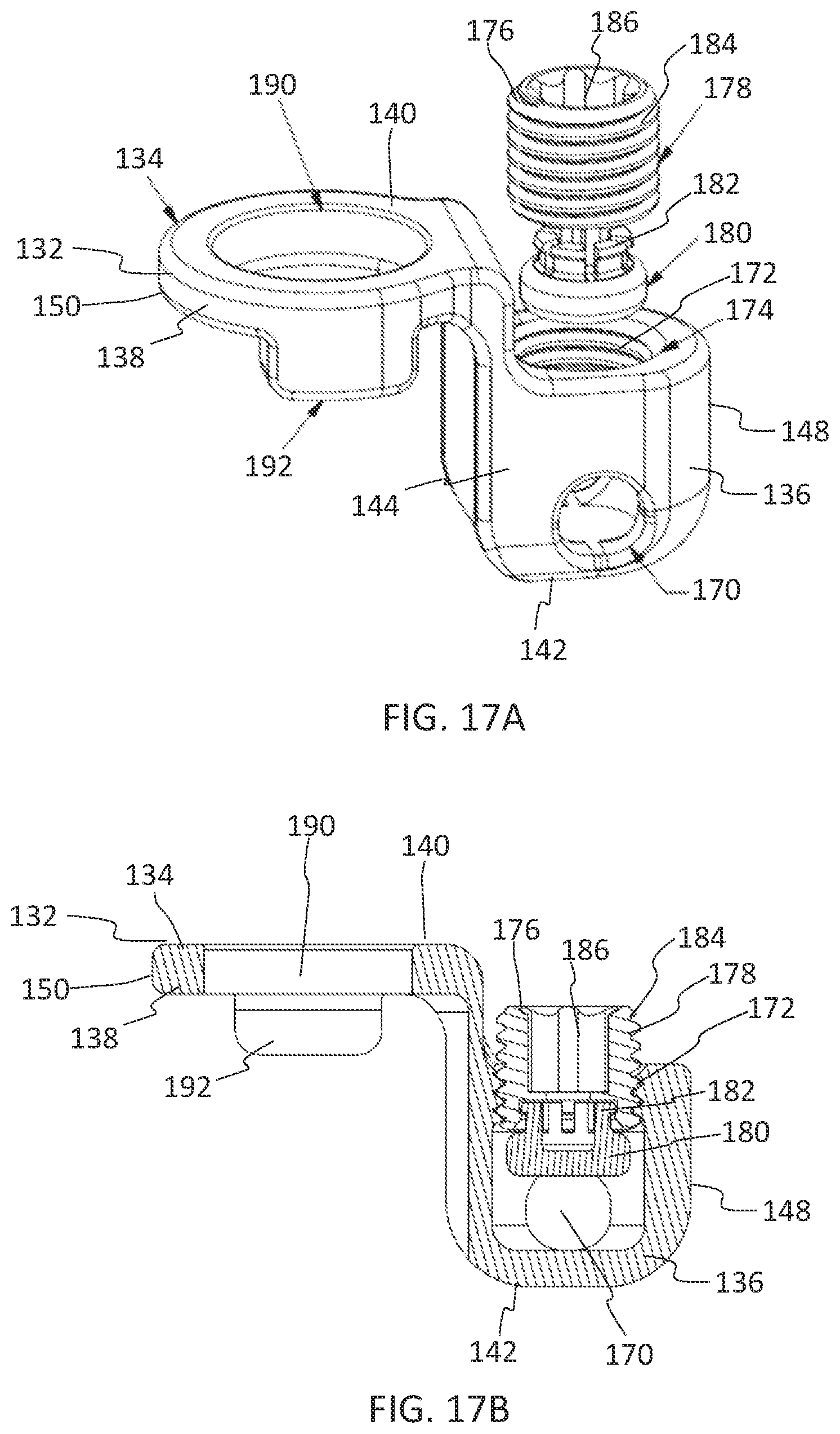 Patent US11771475 Figure 10 – Systems and methods for surgical procedures using band clamp implants and tensioning instruments