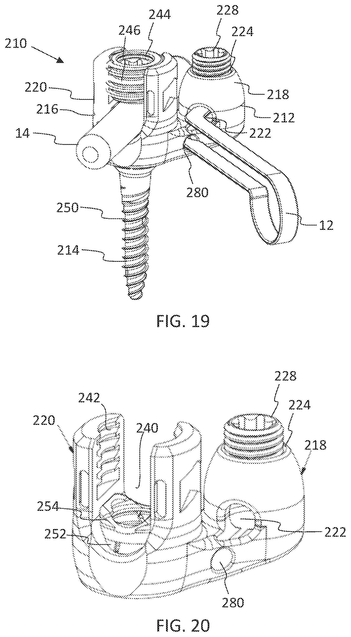 Patent US11771475 Figure 12 – Systems and methods for surgical procedures using band clamp implants and tensioning instruments