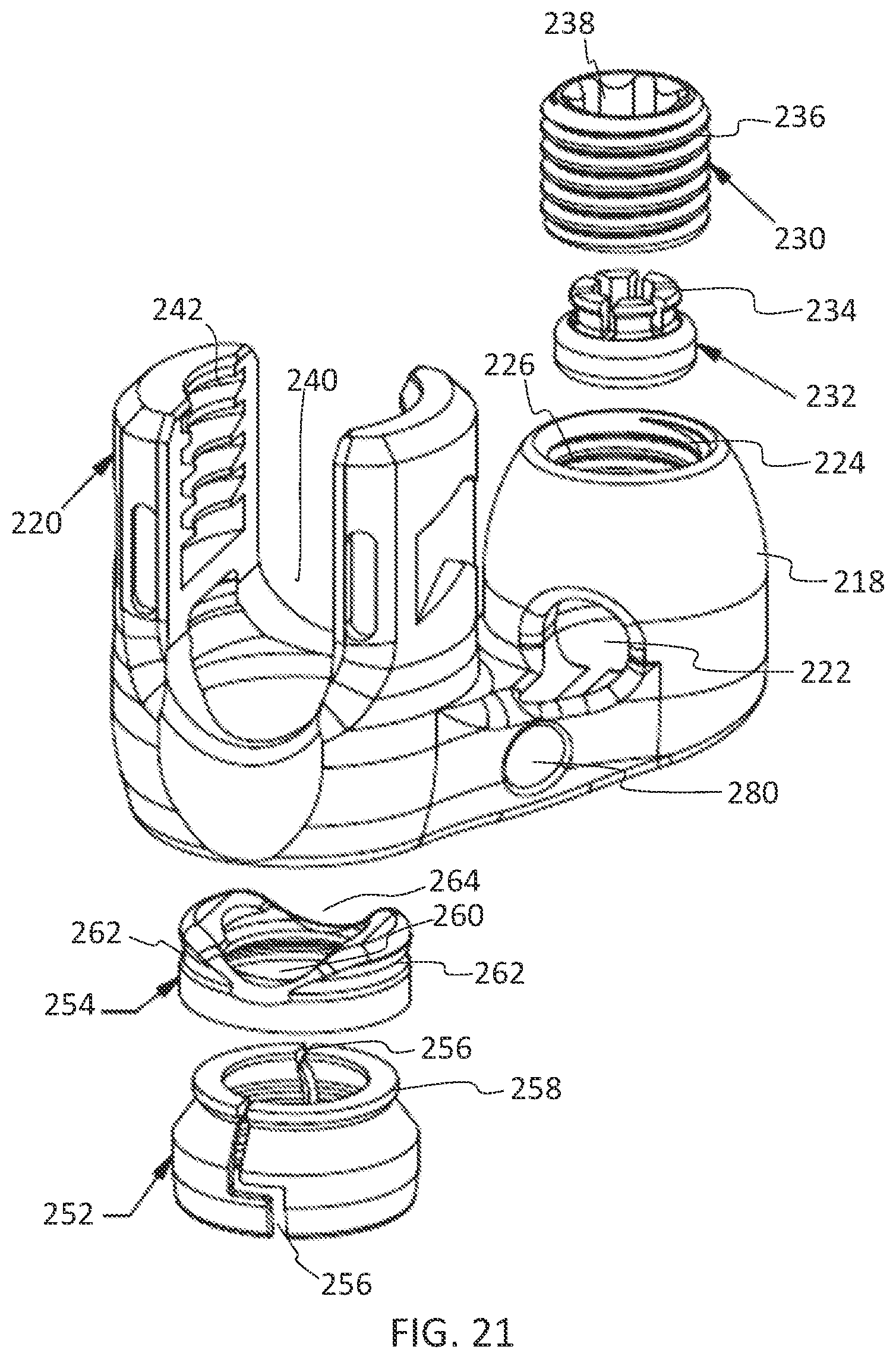Patent US11771475 Figure 13 – Systems and methods for surgical procedures using band clamp implants and tensioning instruments