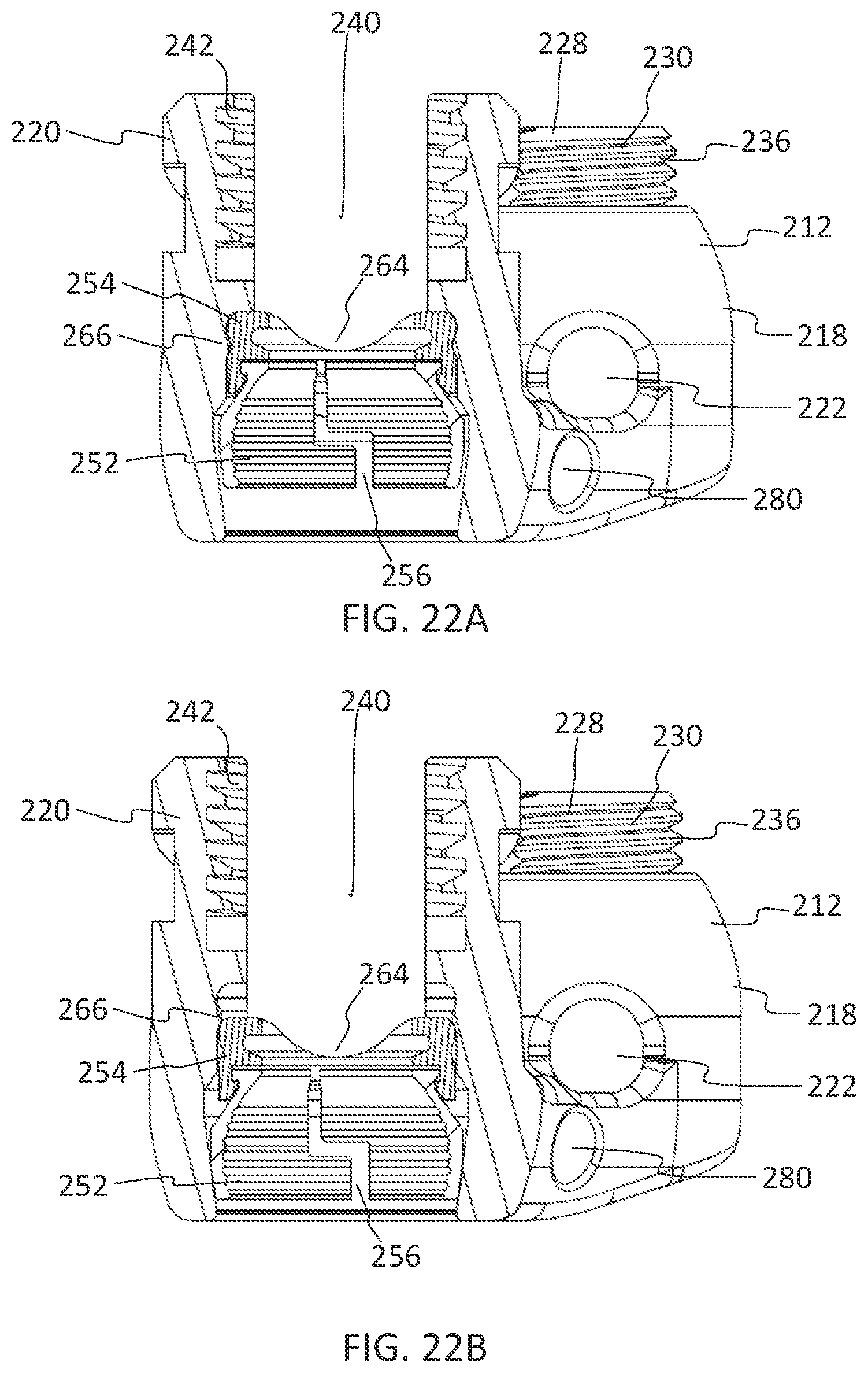 Patent US11771475 Figure 14 – Systems and methods for surgical procedures using band clamp implants and tensioning instruments