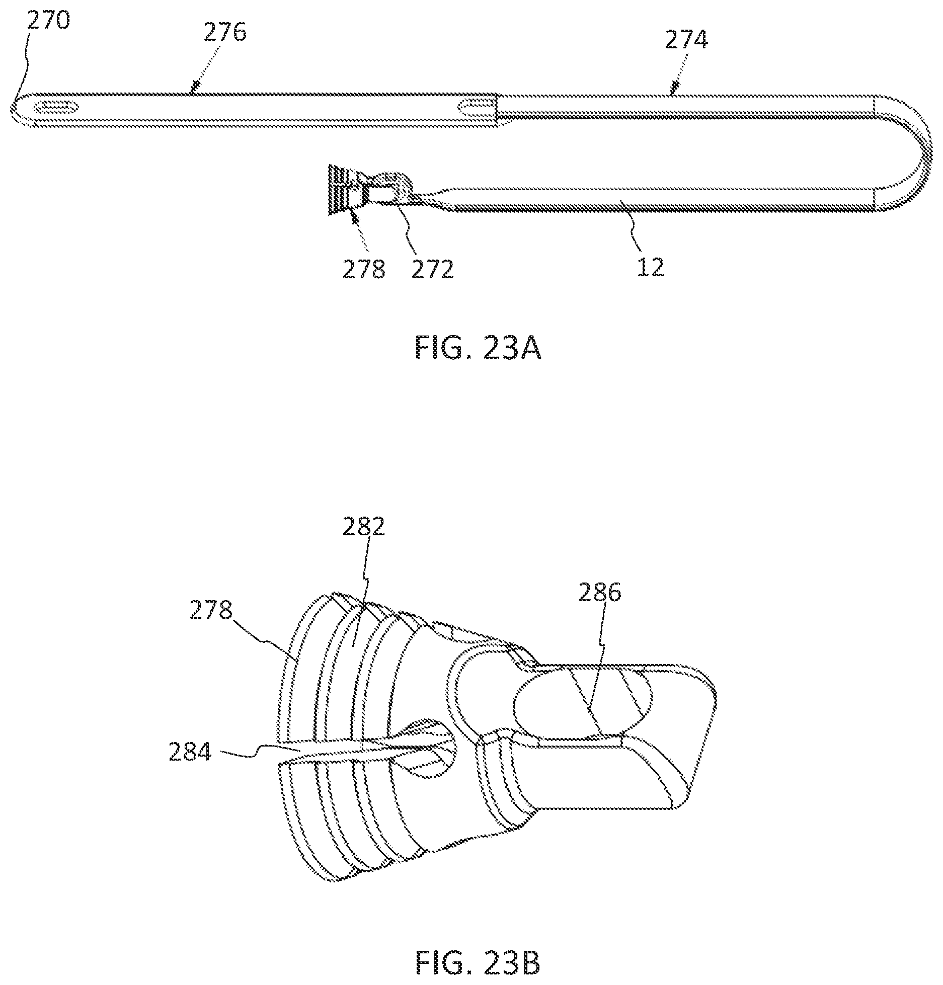 Patent US11771475 Figure 15 – Systems and methods for surgical procedures using band clamp implants and tensioning instruments
