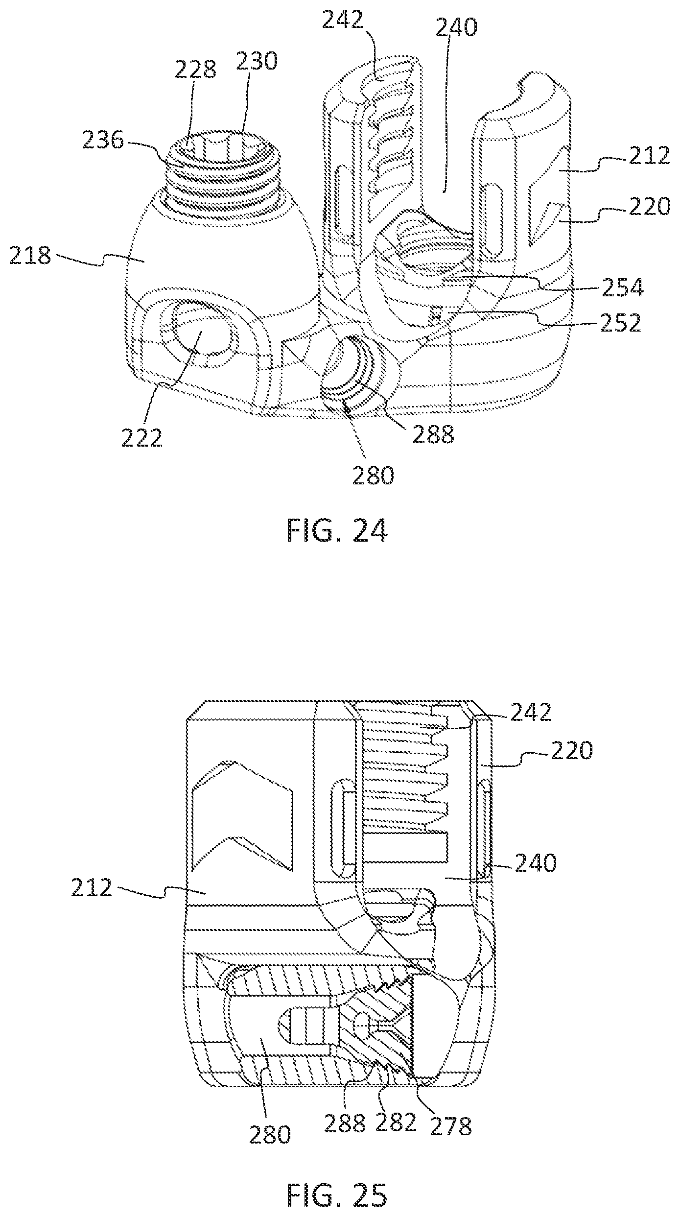 Patent US11771475 Figure 16 – Systems and methods for surgical procedures using band clamp implants and tensioning instruments