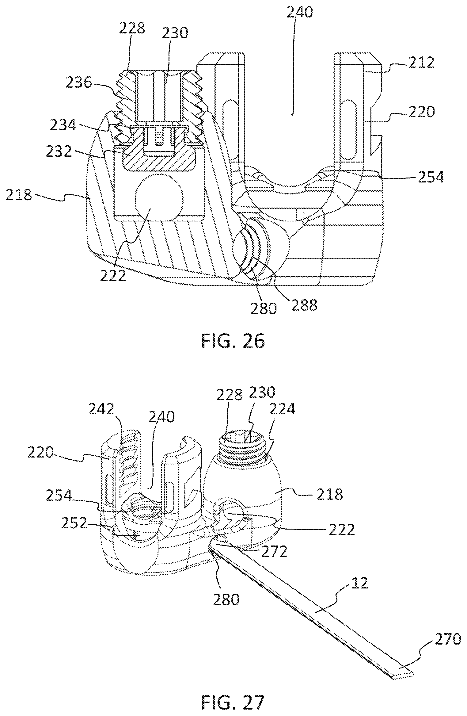 Patent US11771475 Figure 17 – Systems and methods for surgical procedures using band clamp implants and tensioning instruments