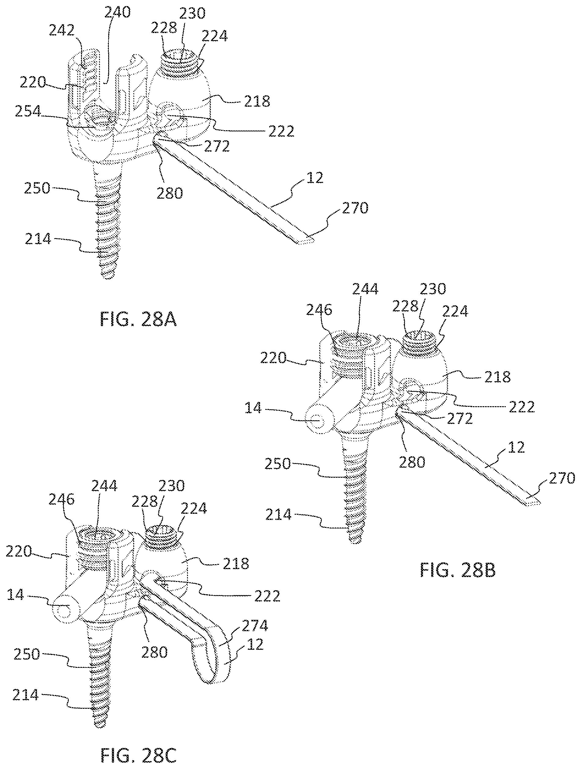 Patent US11771475 Figure 18 – Systems and methods for surgical procedures using band clamp implants and tensioning instruments