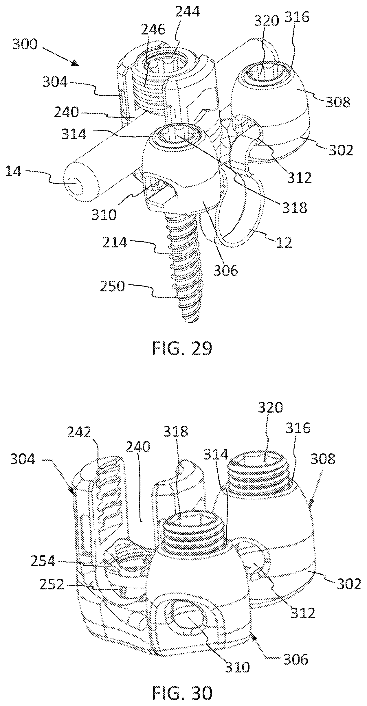 Patent US11771475 Figure 19 – Systems and methods for surgical procedures using band clamp implants and tensioning instruments