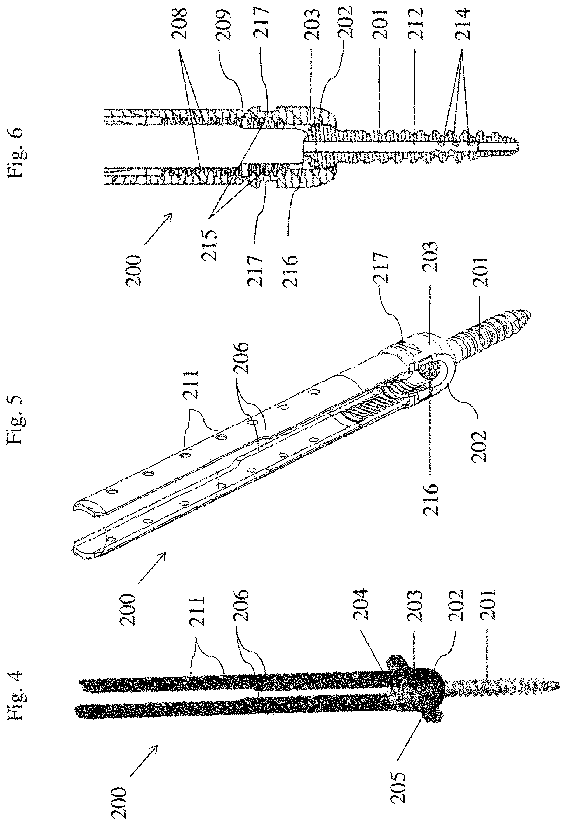 Patent US11771476 Figure 2 – Apparatus and method for fenestrated screw augmentation