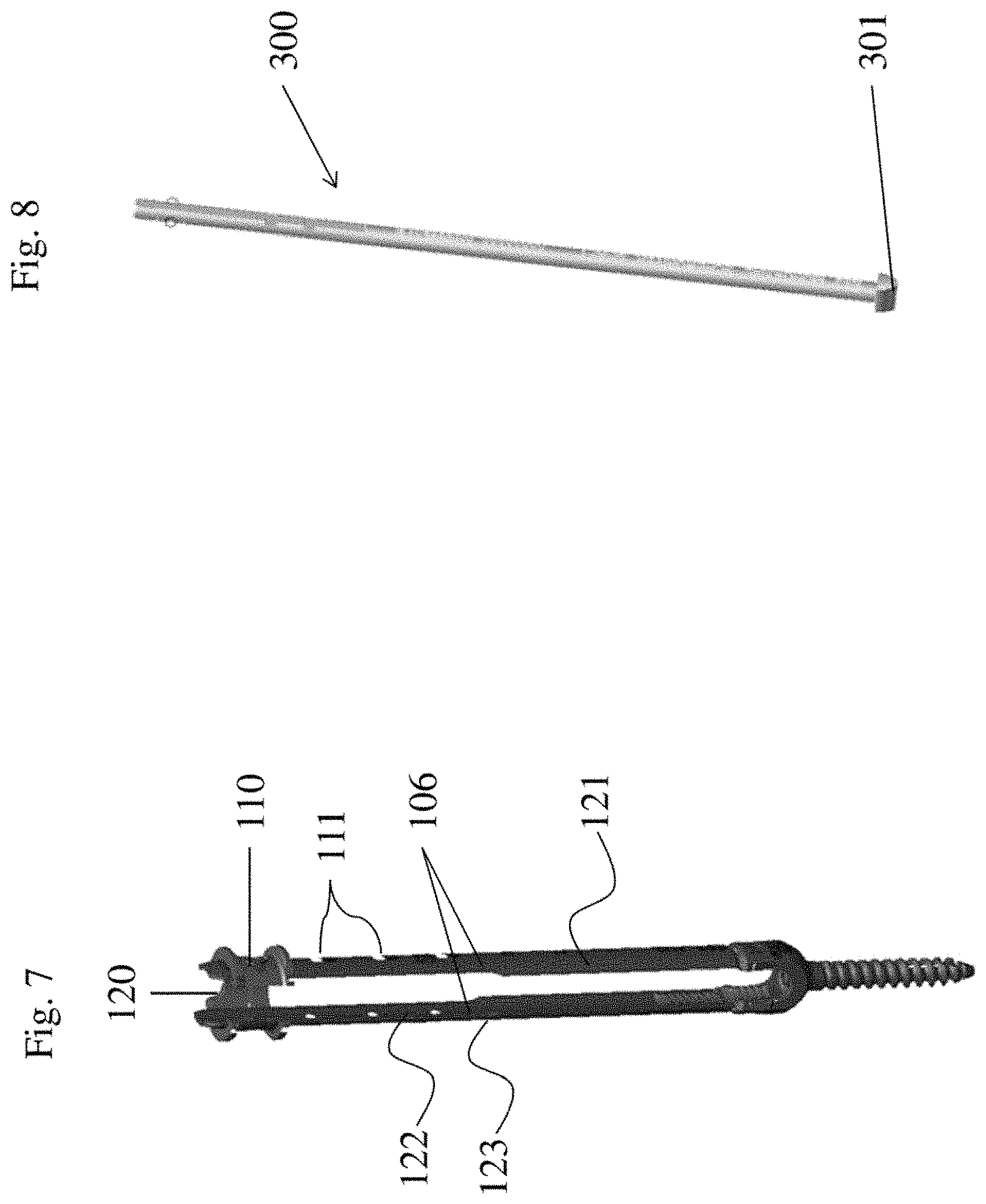 Patent US11771476 Figure 3 – Apparatus and method for fenestrated screw augmentation
