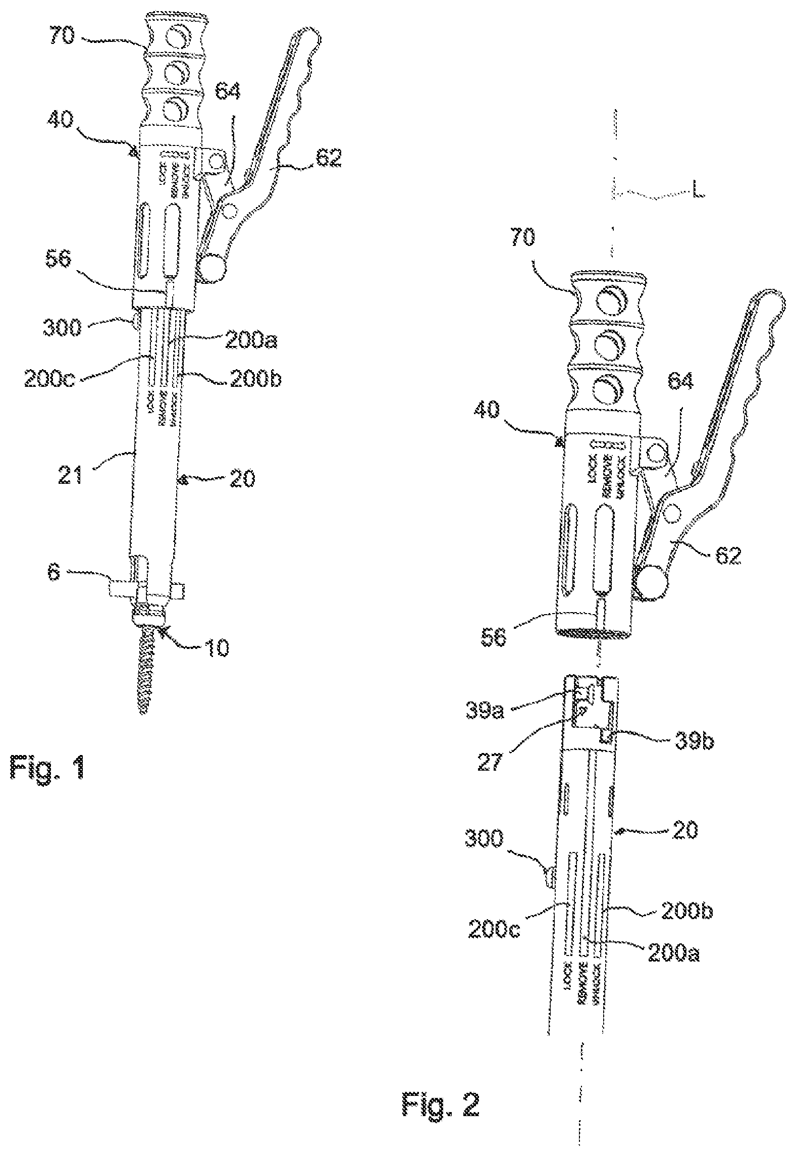 Patent US11771478 Figure 1 – Instrument for locking and unlocking a head of a bone anchor in a polyaxial bone anchoring device