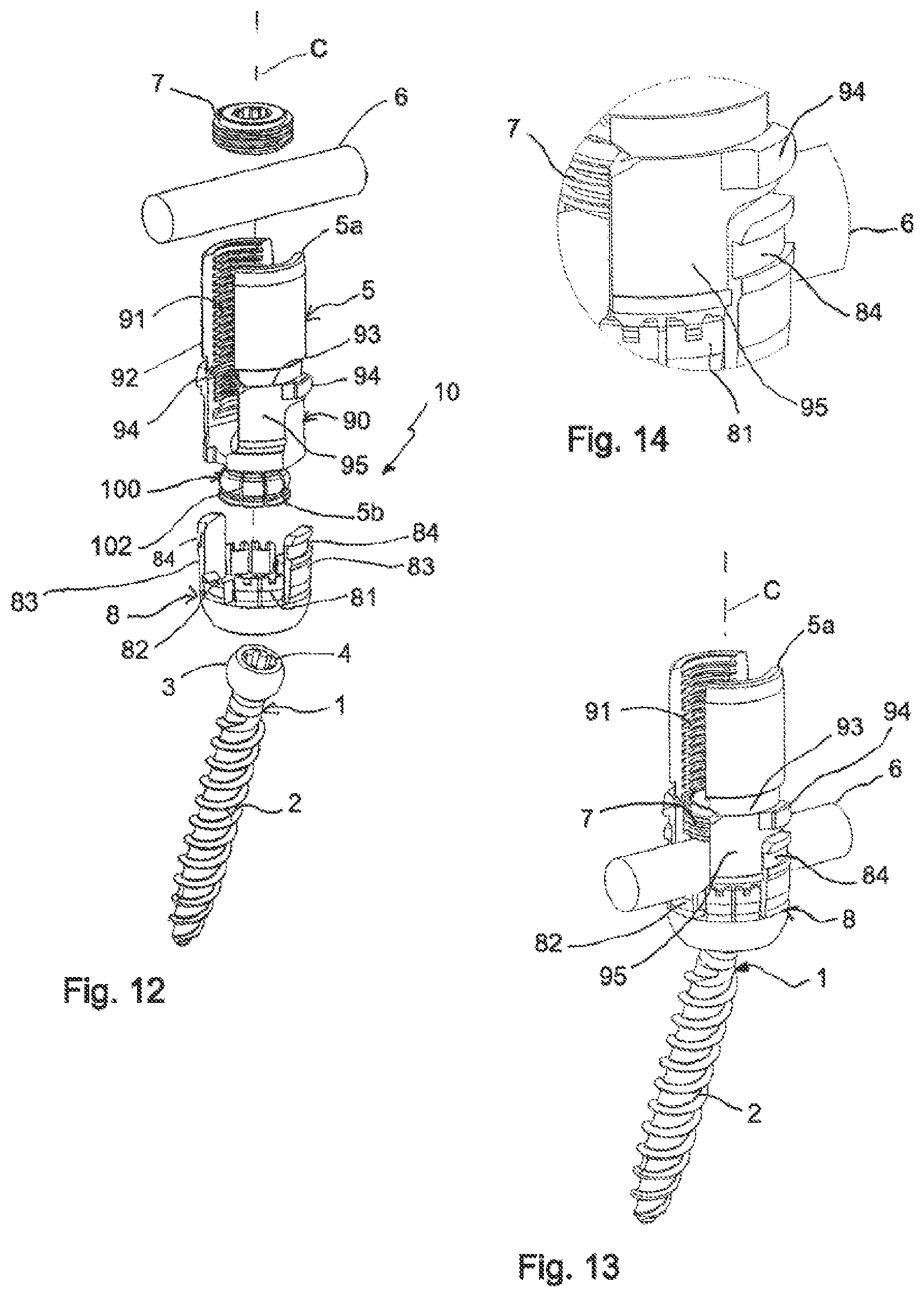Patent US11771478 Figure 6 – Instrument for locking and unlocking a head of a bone anchor in a polyaxial bone anchoring device