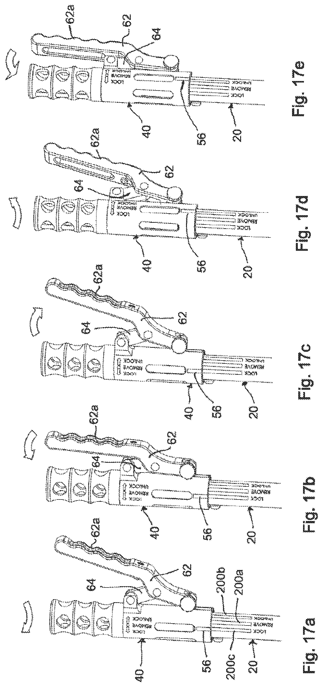Patent US11771478 Figure 9 – Instrument for locking and unlocking a head of a bone anchor in a polyaxial bone anchoring device