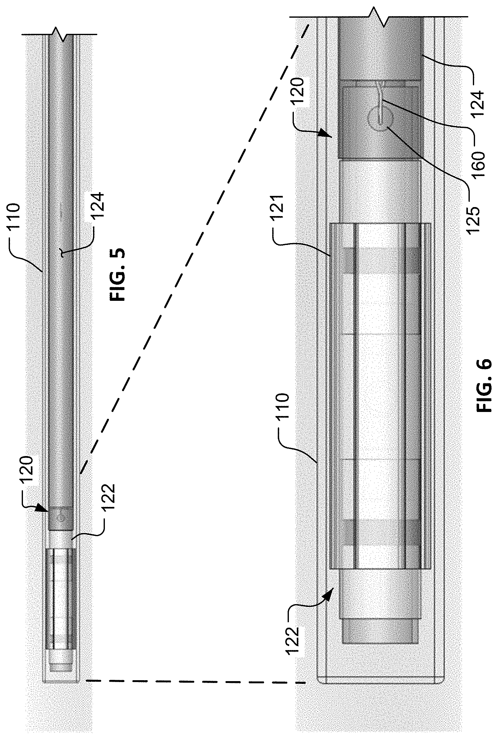 Patent US11771479 Figure 4 – Kyphoplasty system and method