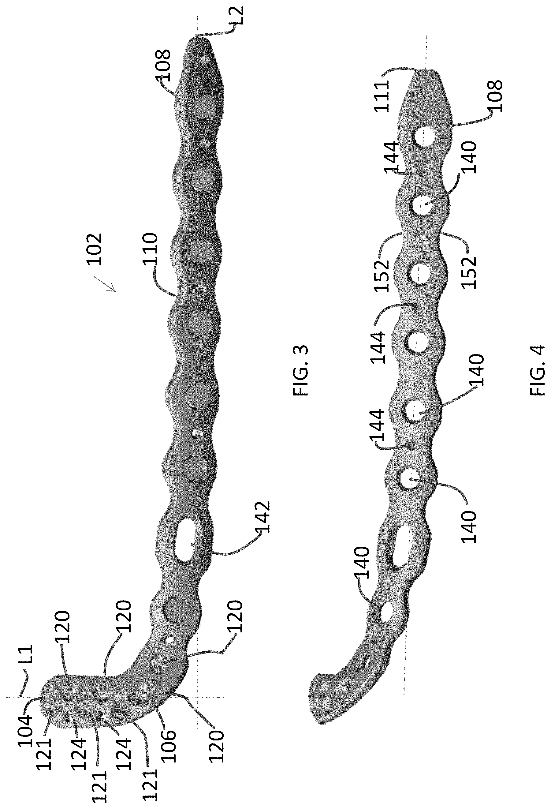 Patent US11771480 Figure 2 – Distal tibial plating system