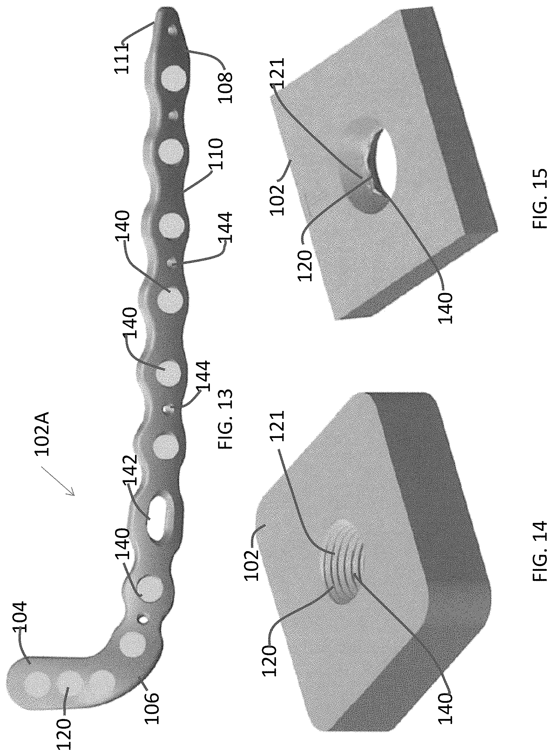 Patent US11771480 Figure 6 – Distal tibial plating system