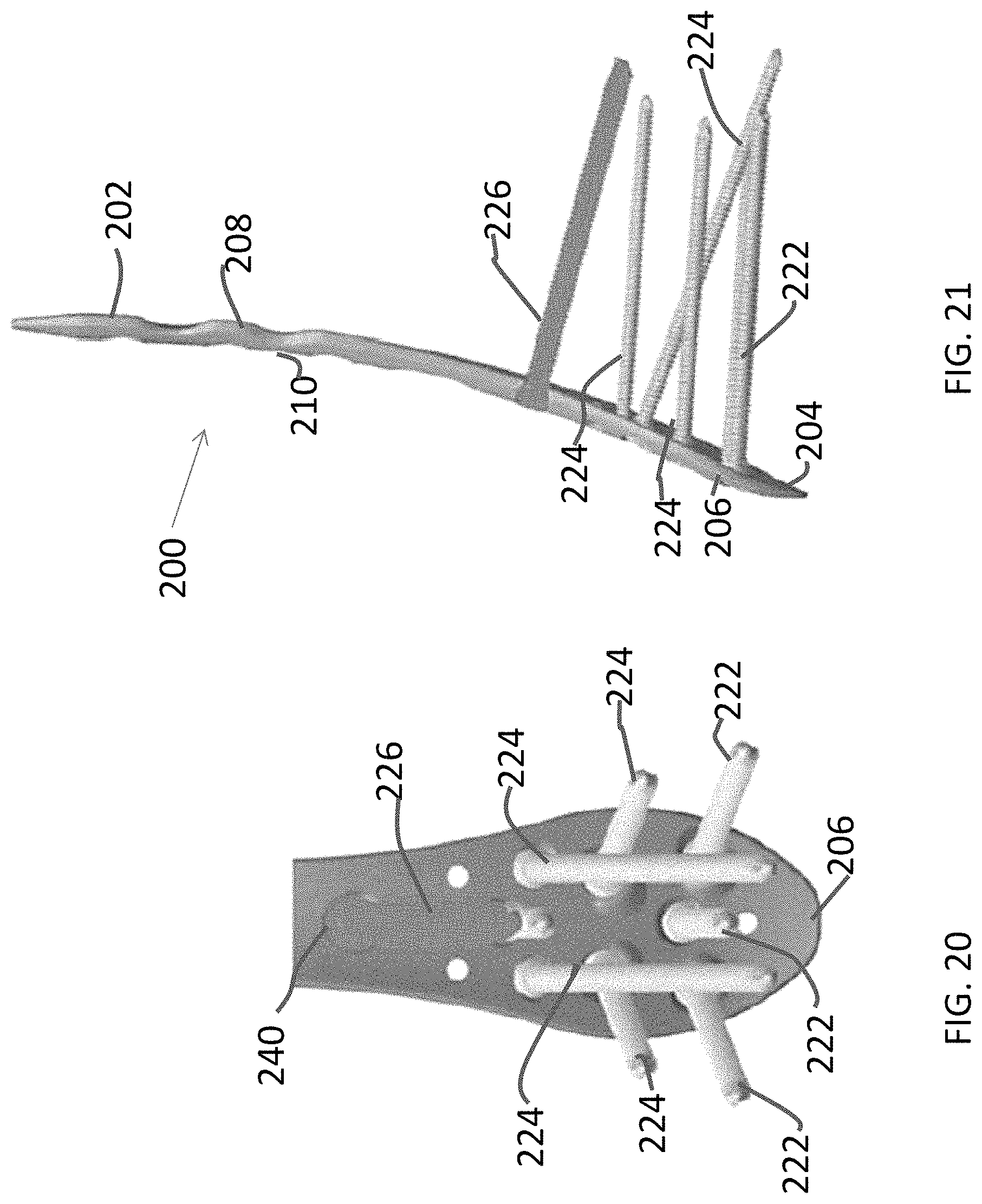 Patent US11771480 Figure 9 – Distal tibial plating system