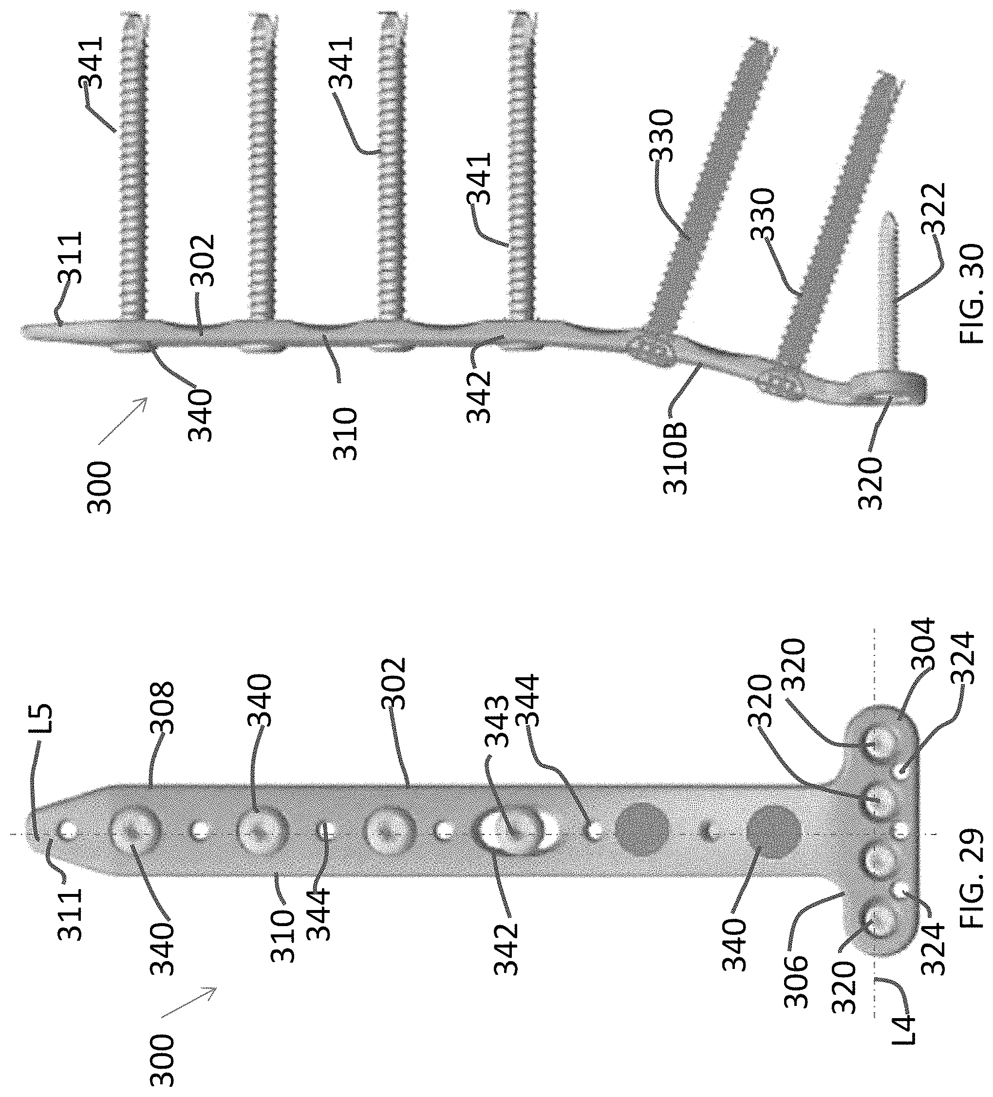 Patent US11771480 Figure 13 – Distal tibial plating system