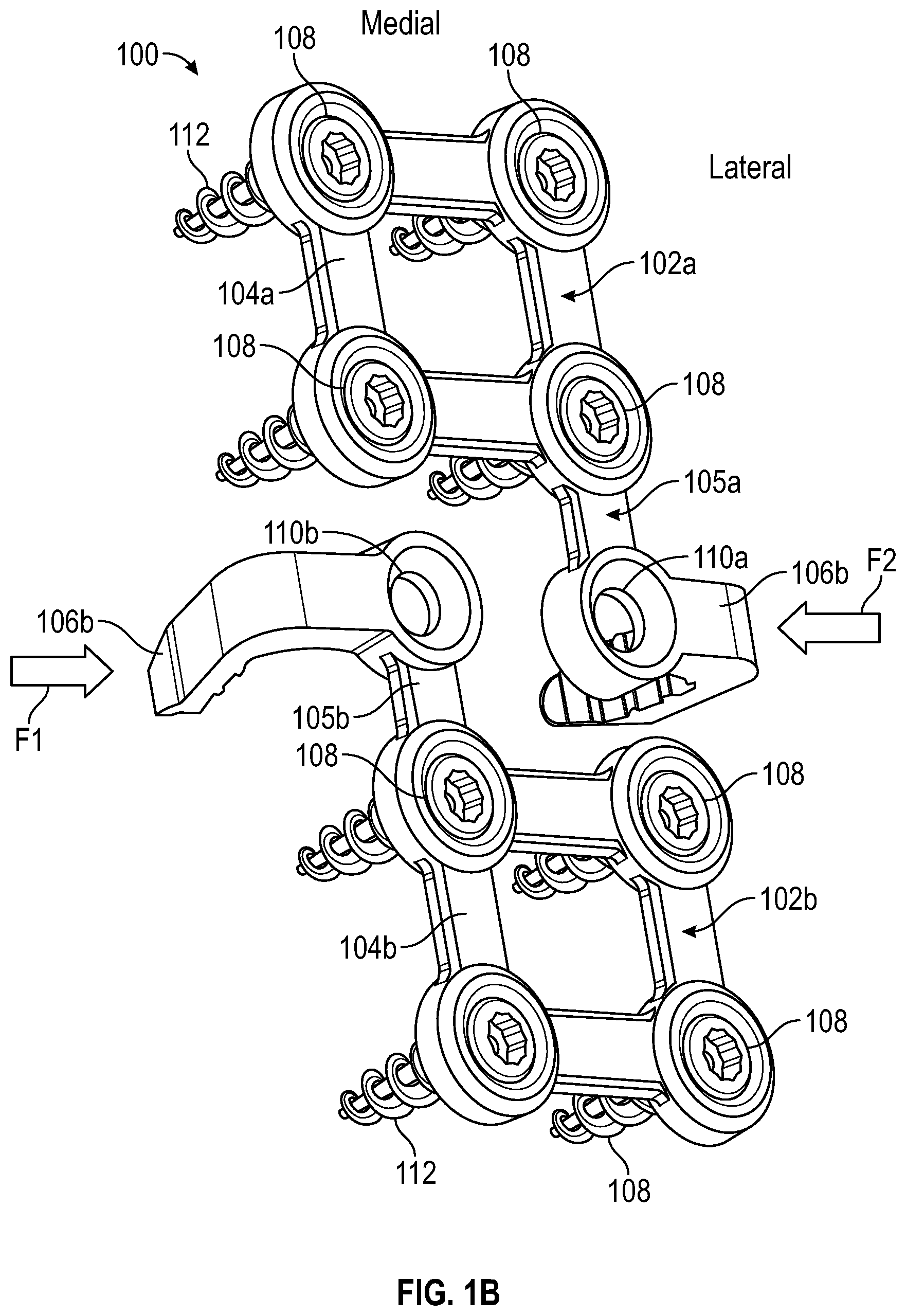 Patent US11771481 Figure 2 – Sternal plates and methods of use