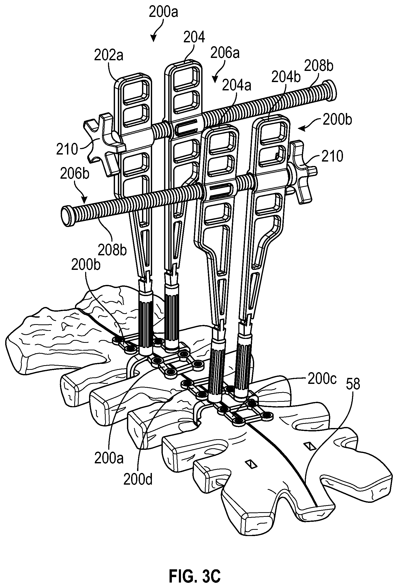 Patent US11771481 Figure 9 – Sternal plates and methods of use