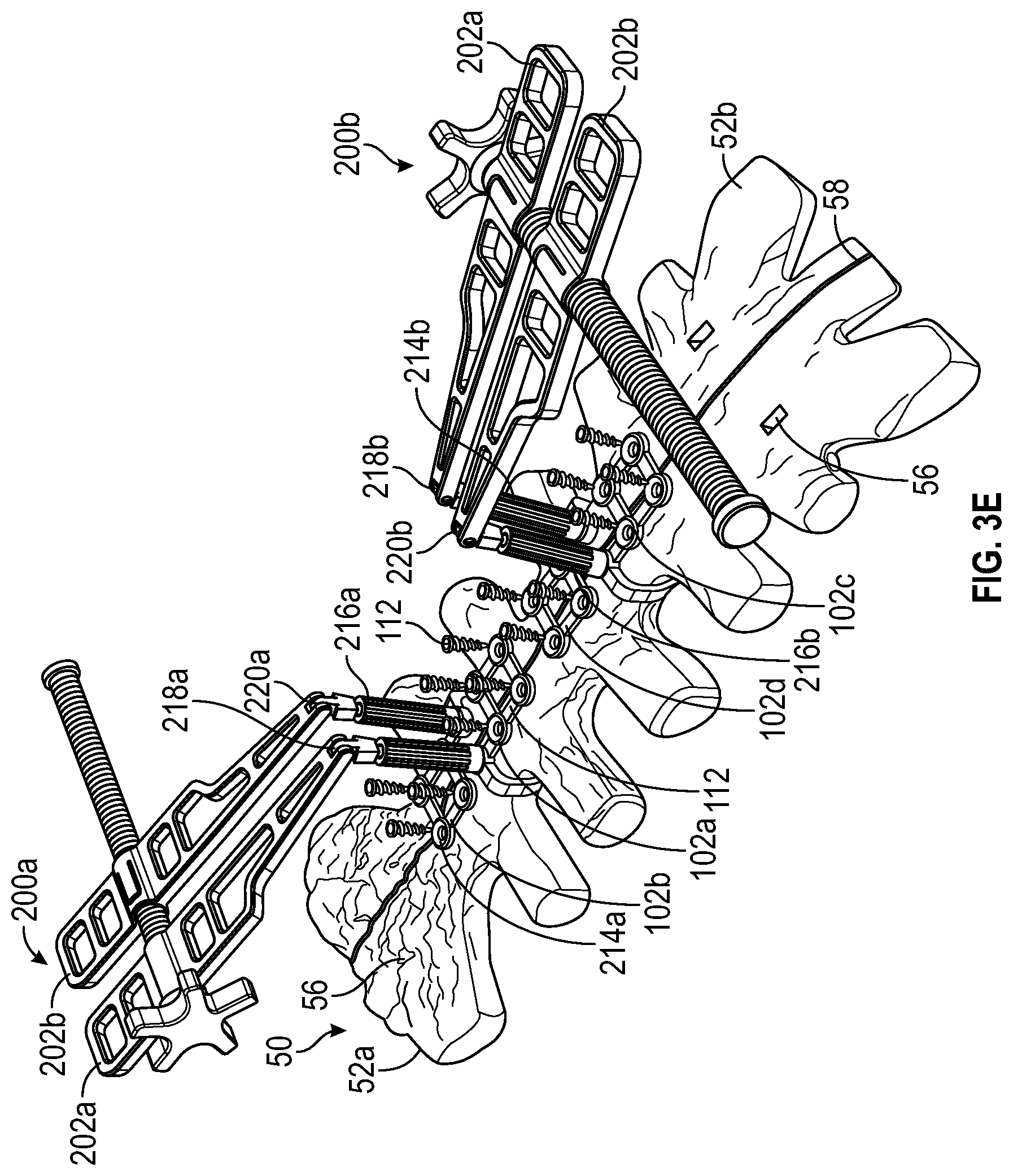 Patent US11771481 Figure 11 – Sternal plates and methods of use