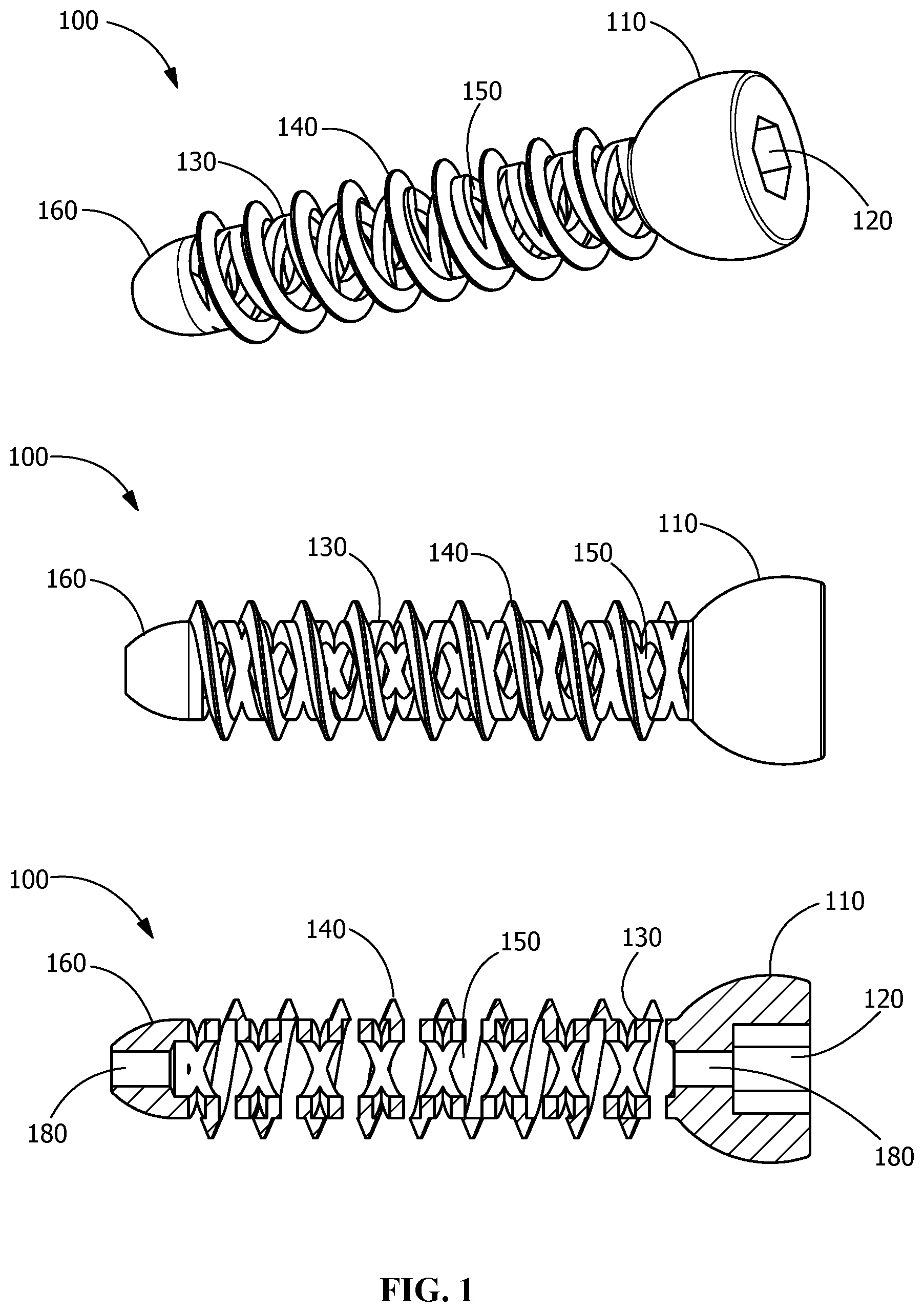 Patent US11771482 Figure 1 – Implants for tissue fixation and fusion