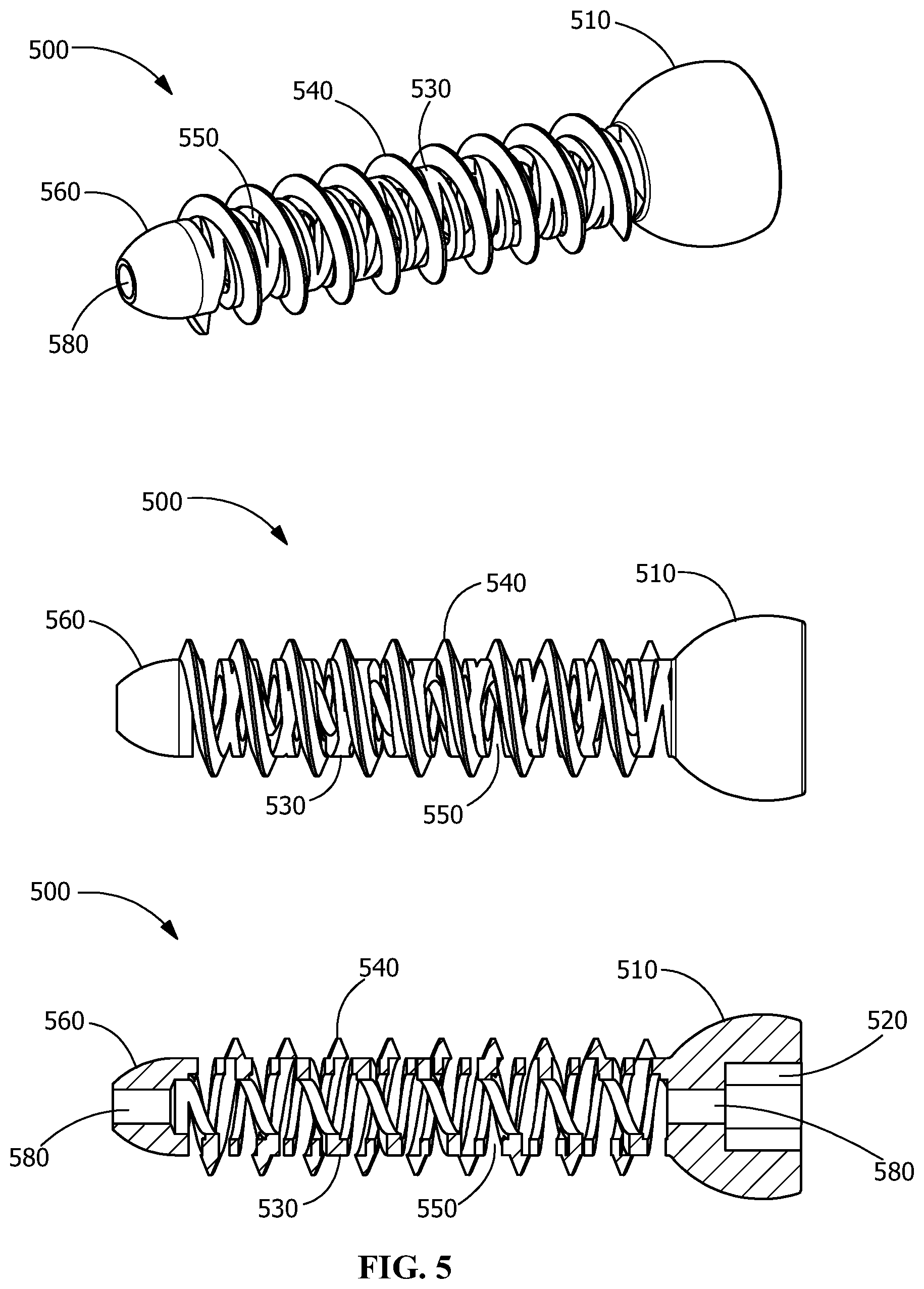 Patent US11771482 Figure 5 – Implants for tissue fixation and fusion