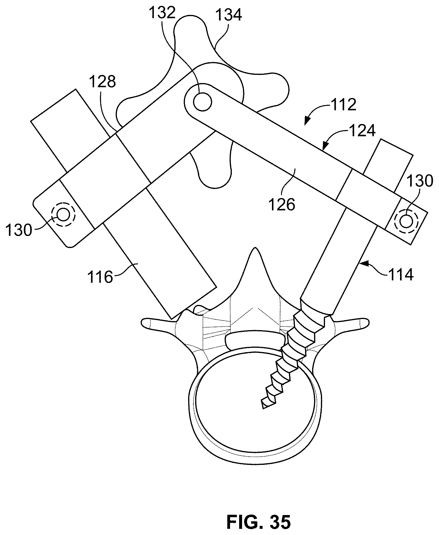 Patent US11771483 Figure 17 – Minimal impact access system to disc space