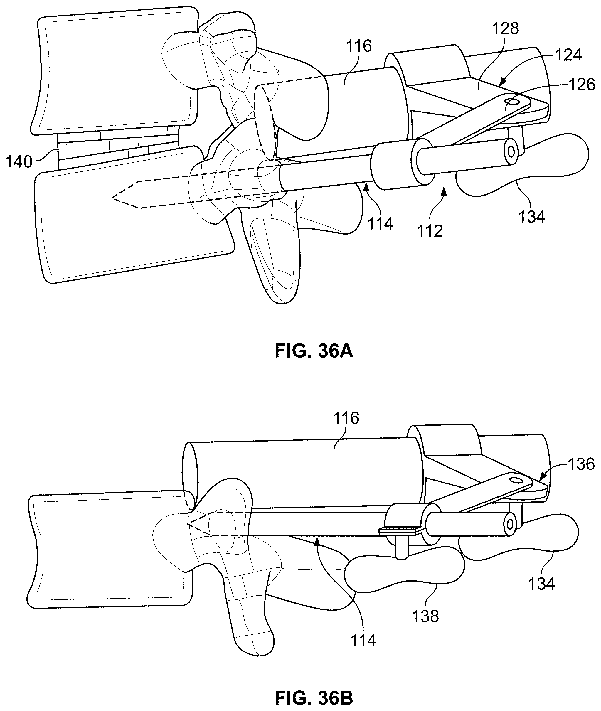 Patent US11771483 Figure 18 – Minimal impact access system to disc space