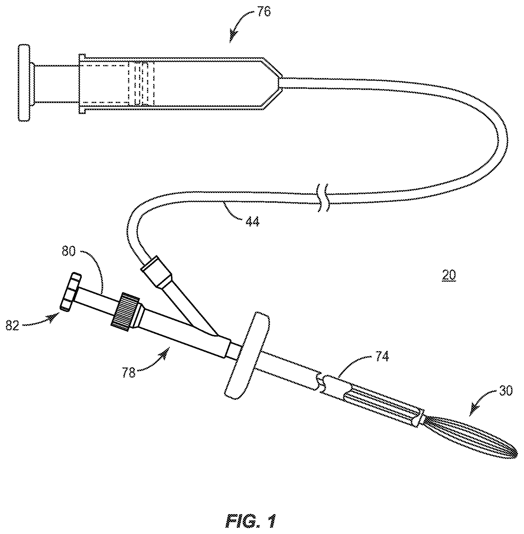 Patent US11771485 Figure 1 – Device for performing a surgical procedure and method