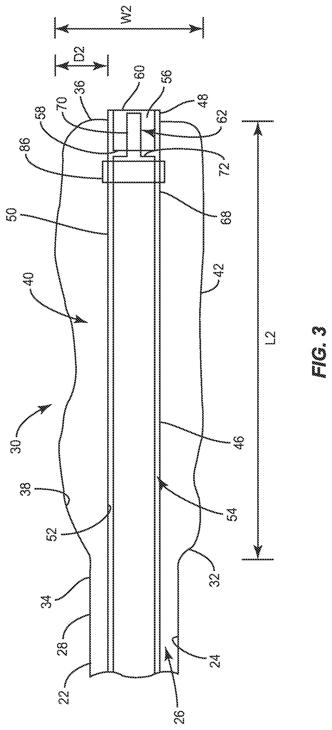 Patent US11771485 Figure 3 – Device for performing a surgical procedure and method