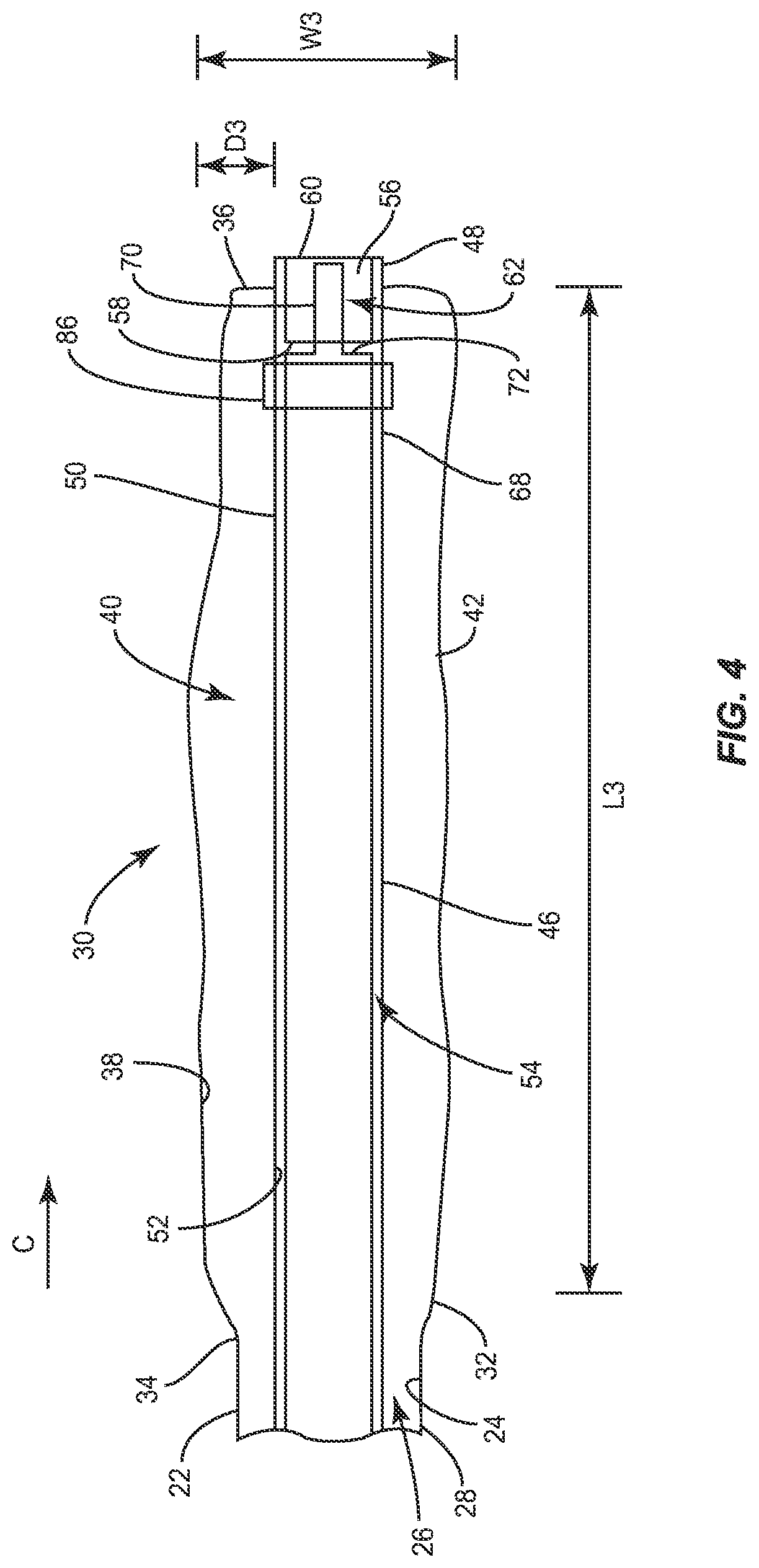 Patent US11771485 Figure 4 – Device for performing a surgical procedure and method