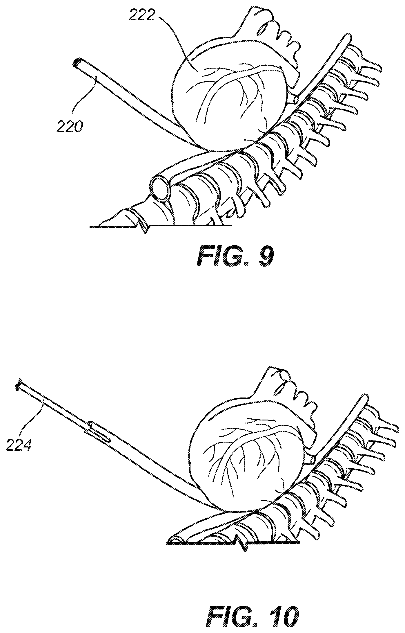 Patent US11771486 Figure 10 – Device for ablation of tissue surfaces and related systems and methods
