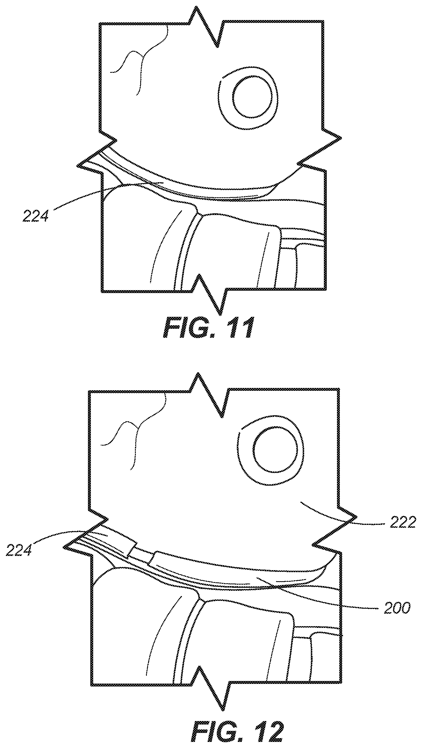 Patent US11771486 Figure 11 – Device for ablation of tissue surfaces and related systems and methods