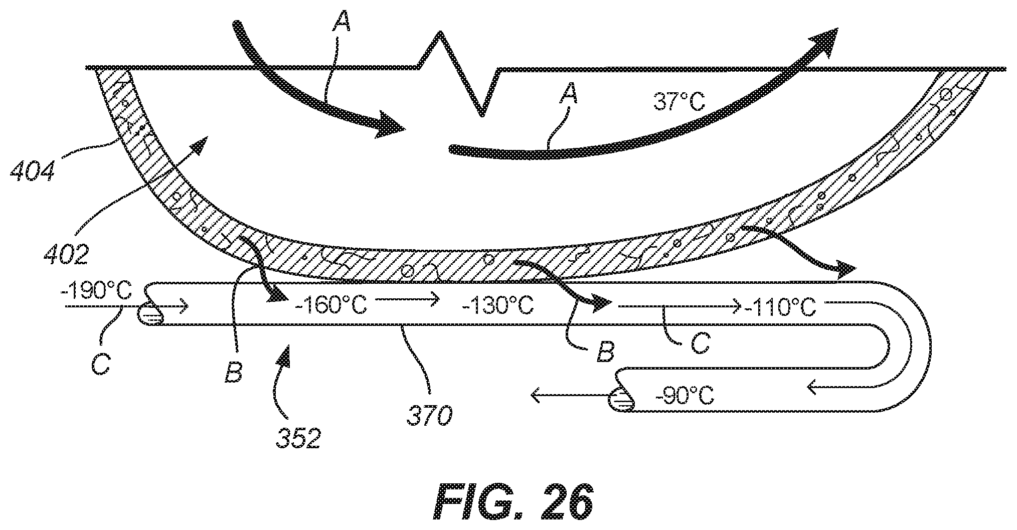 Patent US11771486 Figure 20 – Device for ablation of tissue surfaces and related systems and methods