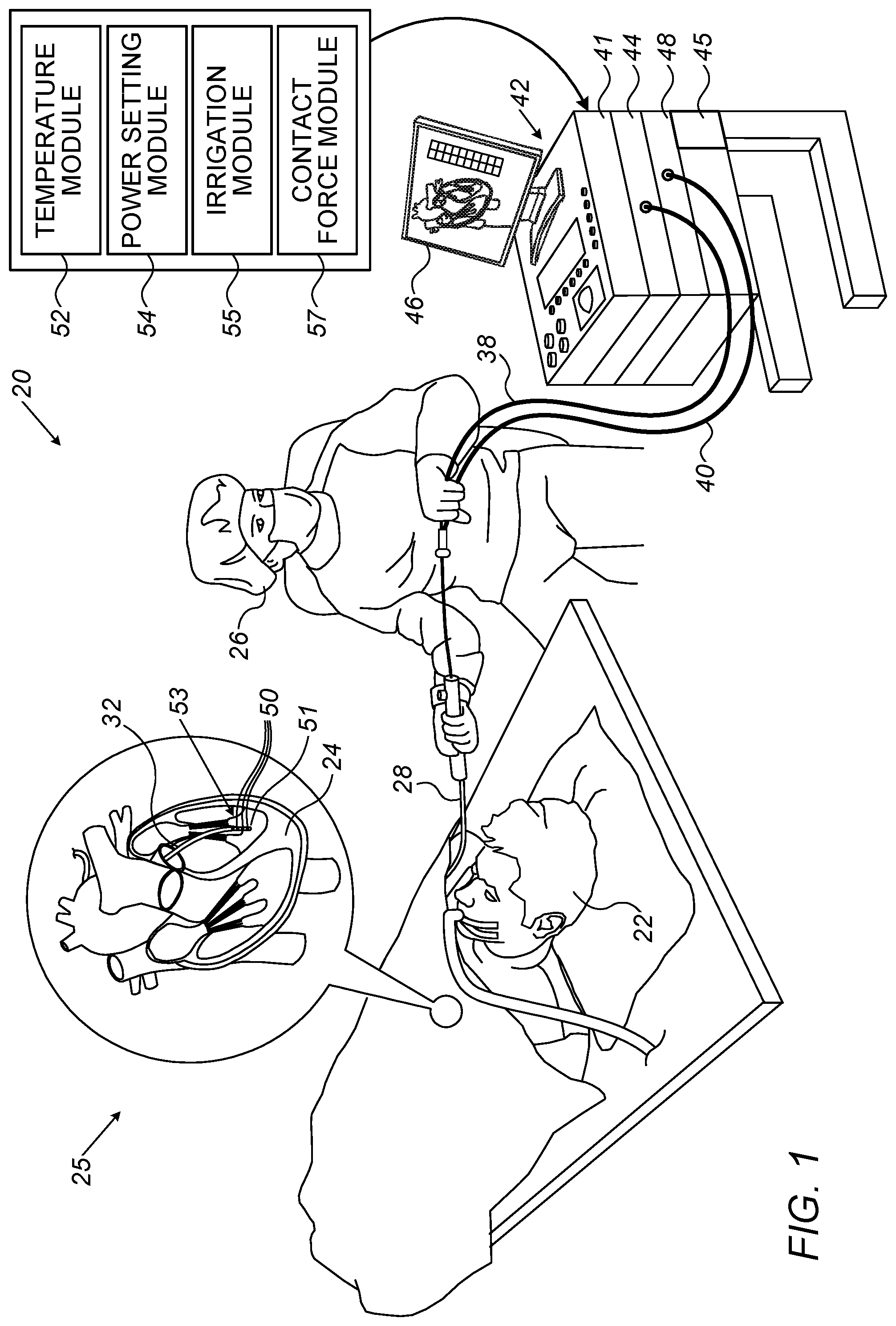 Patent US11771488 Figure 1 – Ablation of lesions of low-medium depths using ultrahigh radiofrequency (RF) power for ultrashort durations