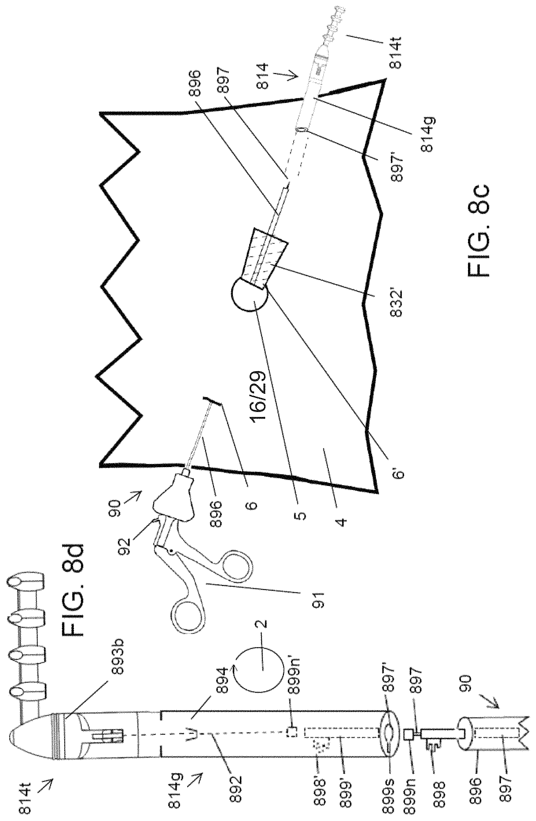 Patent US11771489 Figure 16 – Apparatus and systems for minimally invasive dissection of tissues