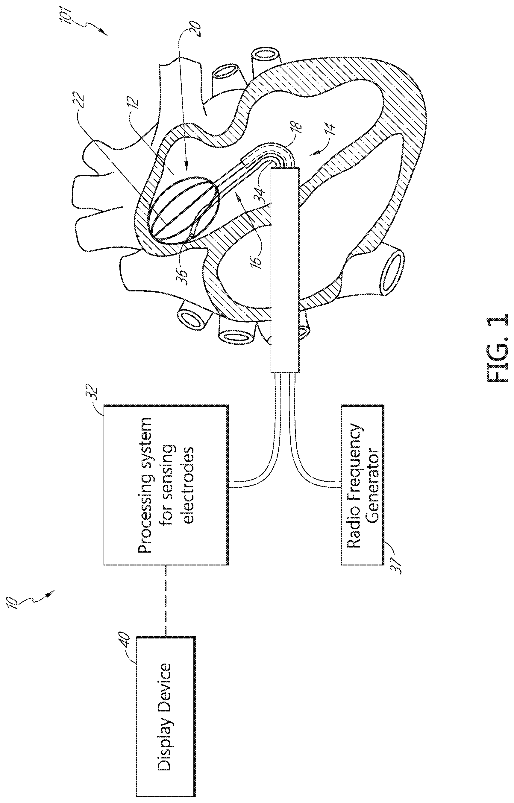 Patent US11771491 Figure 1 – Tissue mapping and treatment