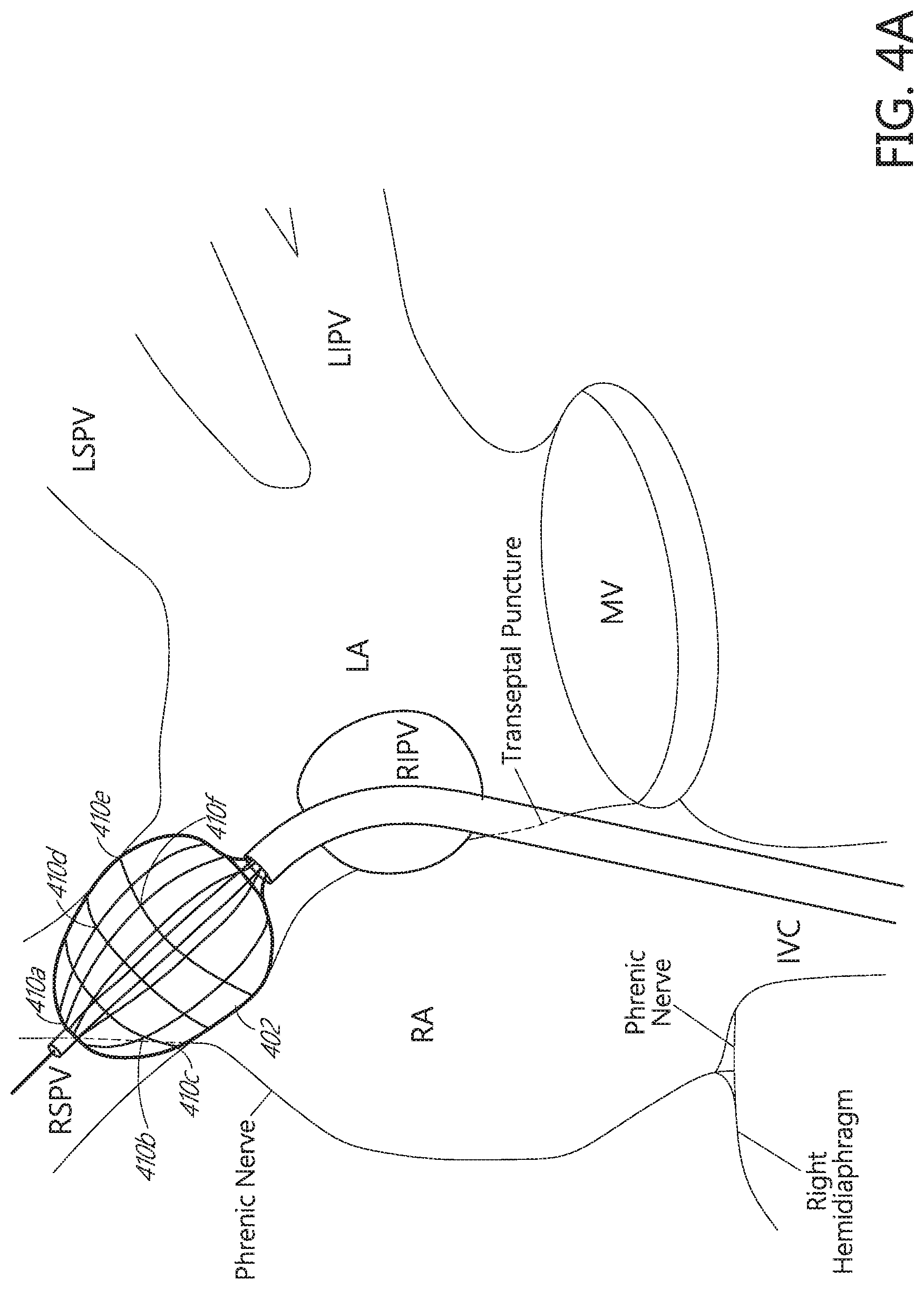 Patent US11771491 Figure 4 – Tissue mapping and treatment
