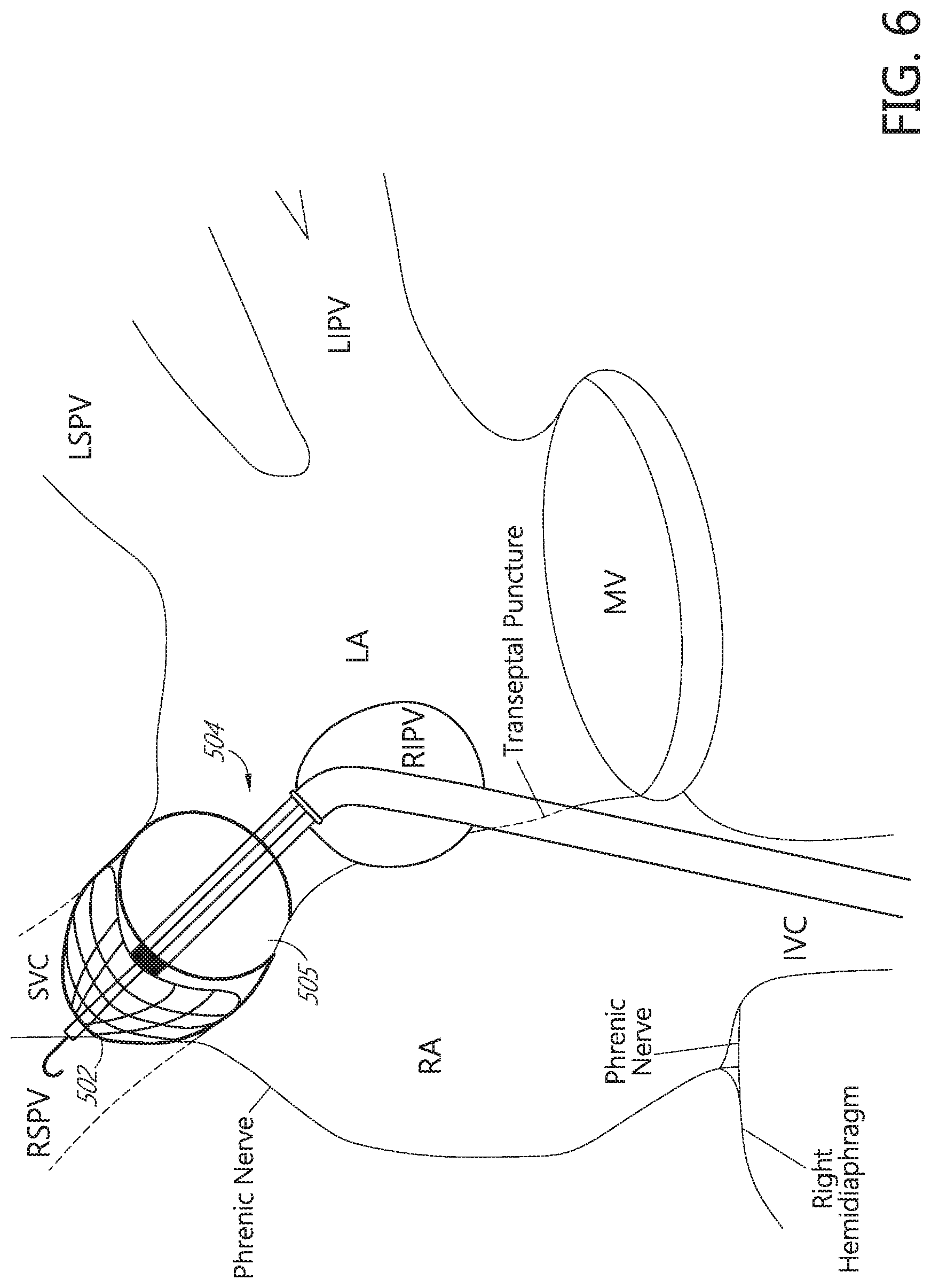 Patent US11771491 Figure 8 – Tissue mapping and treatment