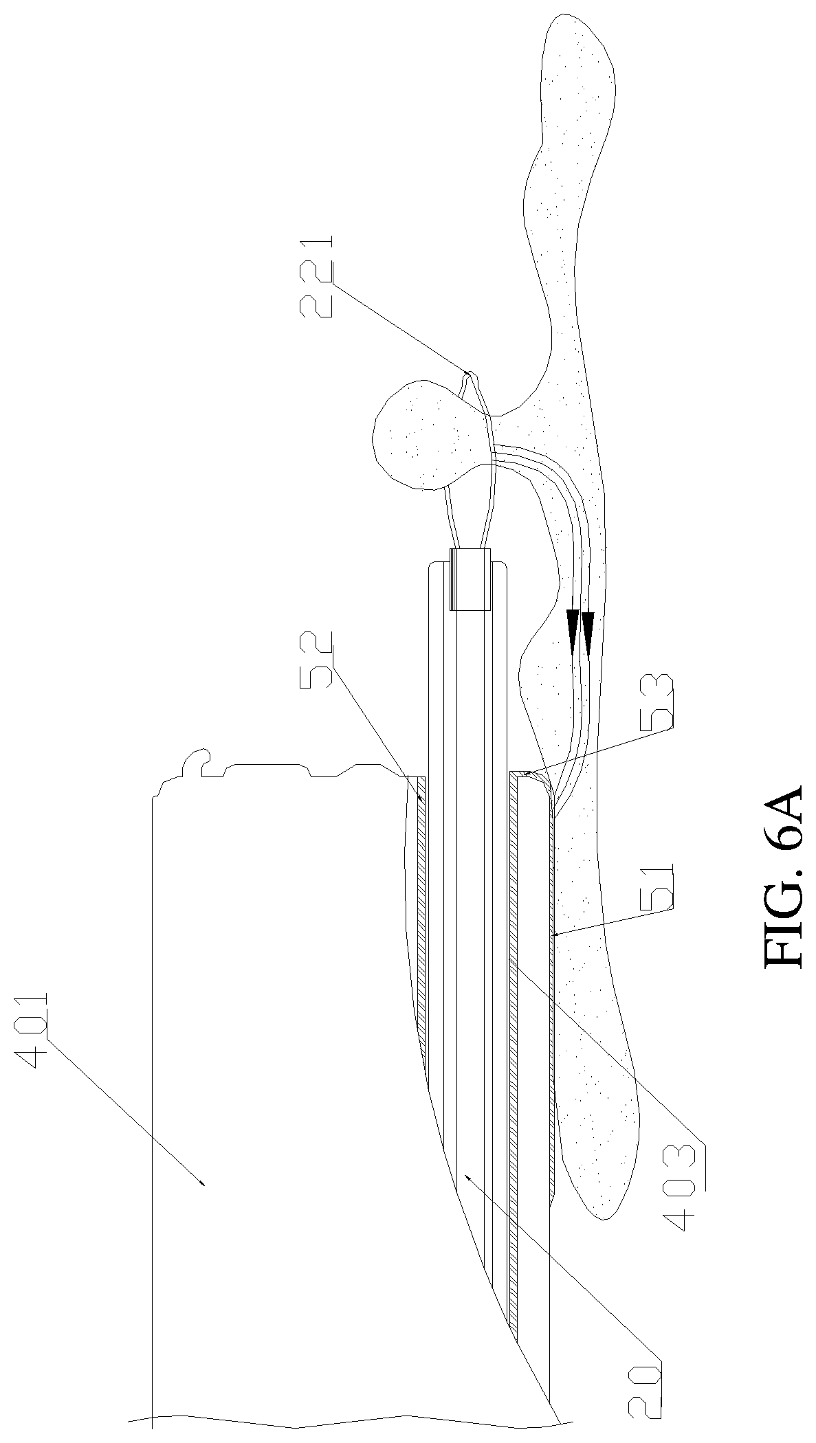 Patent US11771493 Figure 8 – Treatment apparatus for endoscope, endoscope, and expandable frame