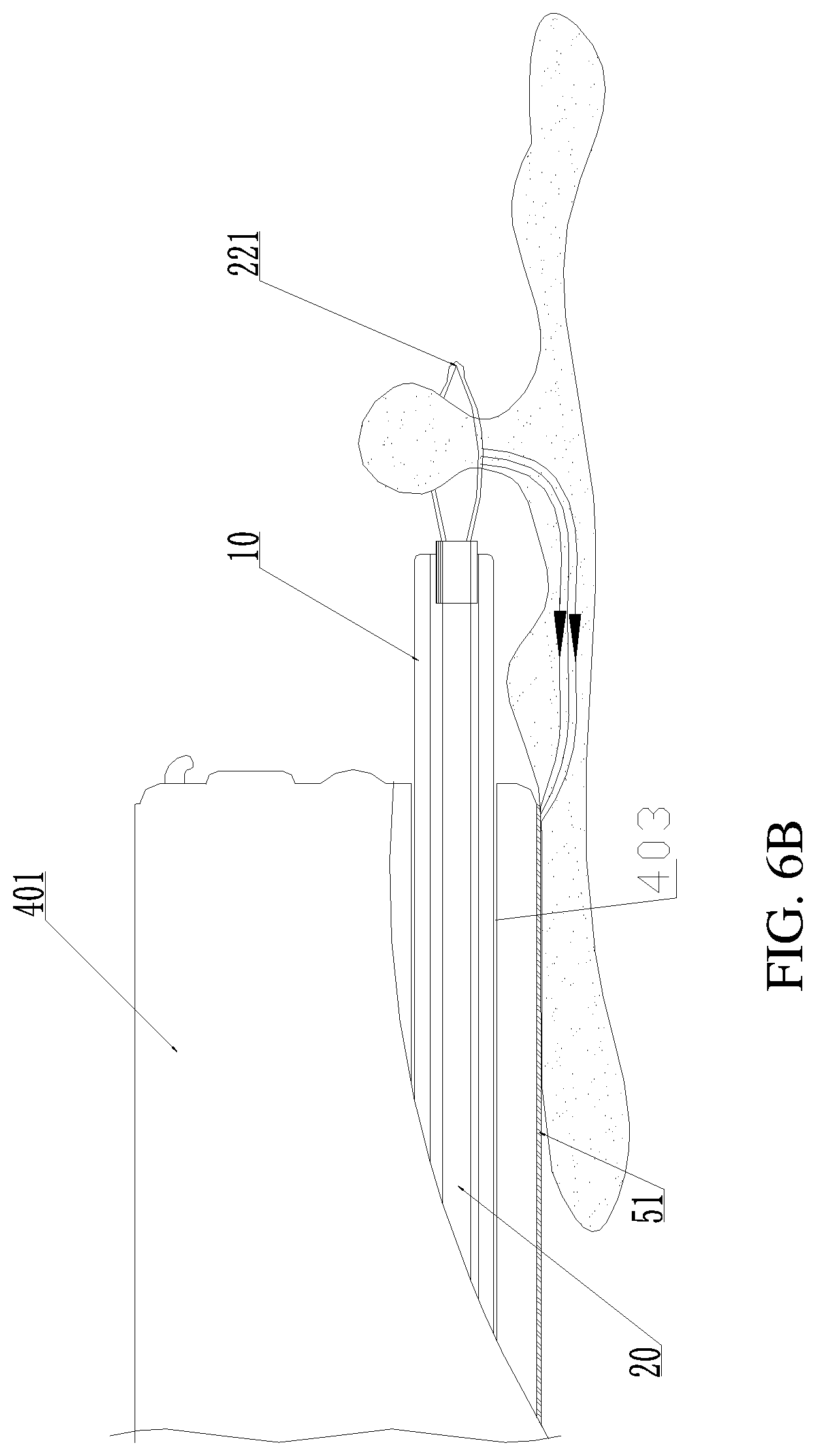 Patent US11771493 Figure 9 – Treatment apparatus for endoscope, endoscope, and expandable frame