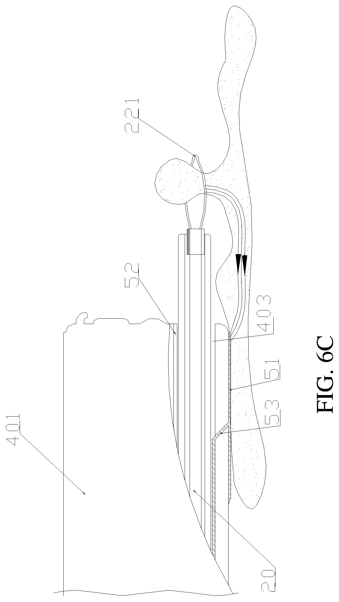Patent US11771493 Figure 10 – Treatment apparatus for endoscope, endoscope, and expandable frame